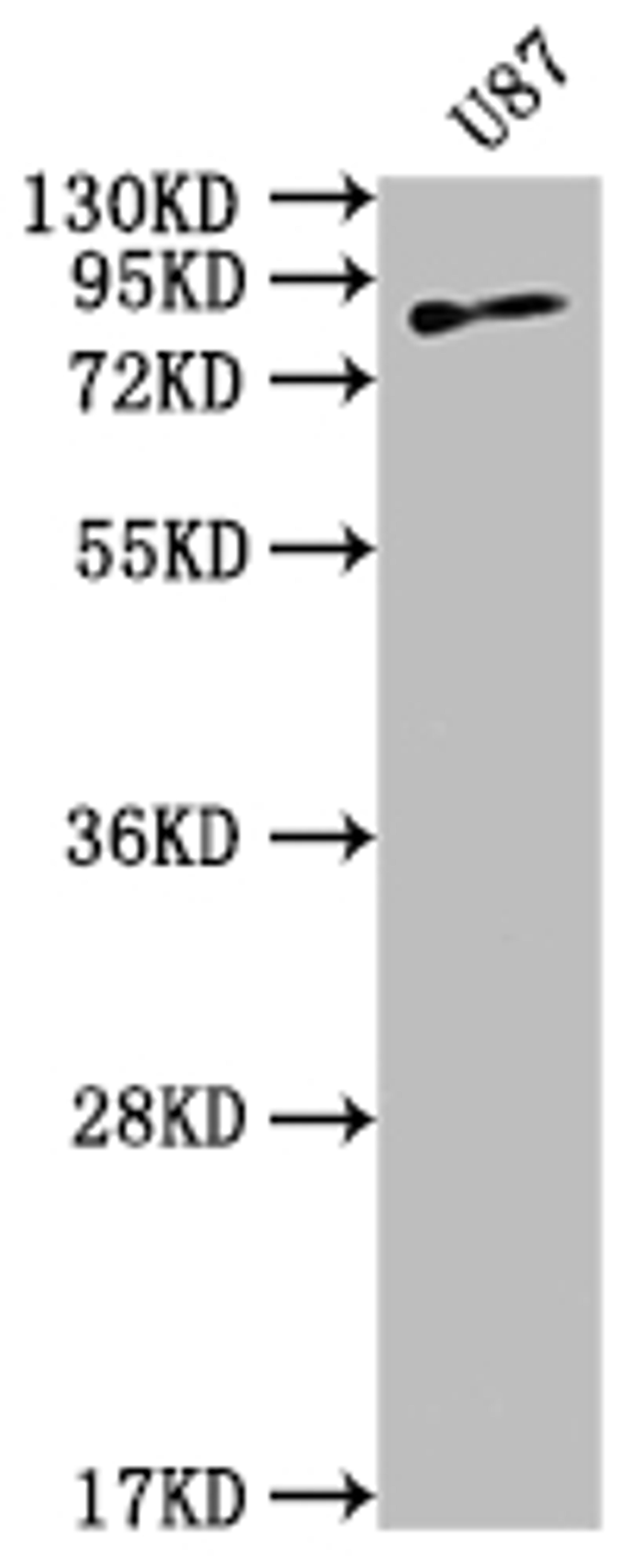 Western Blot. Positive WB detected in: U87 whole cell lysate. All lanes: TGM2 antibody at 1:2000. Secondary. Goat polyclonal to rabbit IgG at 1/50000 dilution. Predicted band size: 78, 62, 39 kDa. Observed band size: 78 kDa. 