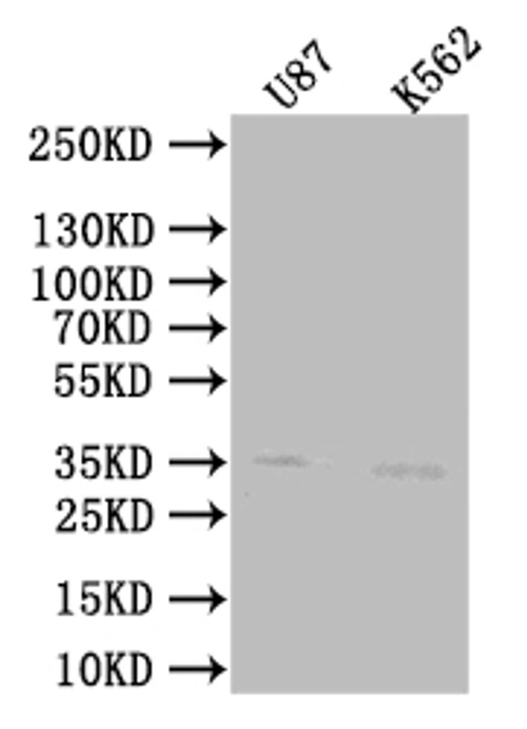 Western Blot. Positive WB detected in:Jurkat whole cell lysate, SH-SY5Y whole cell lysate, mouse kidney tissue lysate. All lanes: SLC25A51 antibody at 1:1000. Secondary. Goat polyclonal to rabbit IgG at 1/50000 dilution. Predicted band size: 34 kDa. Observed band size: 34 kDa. 