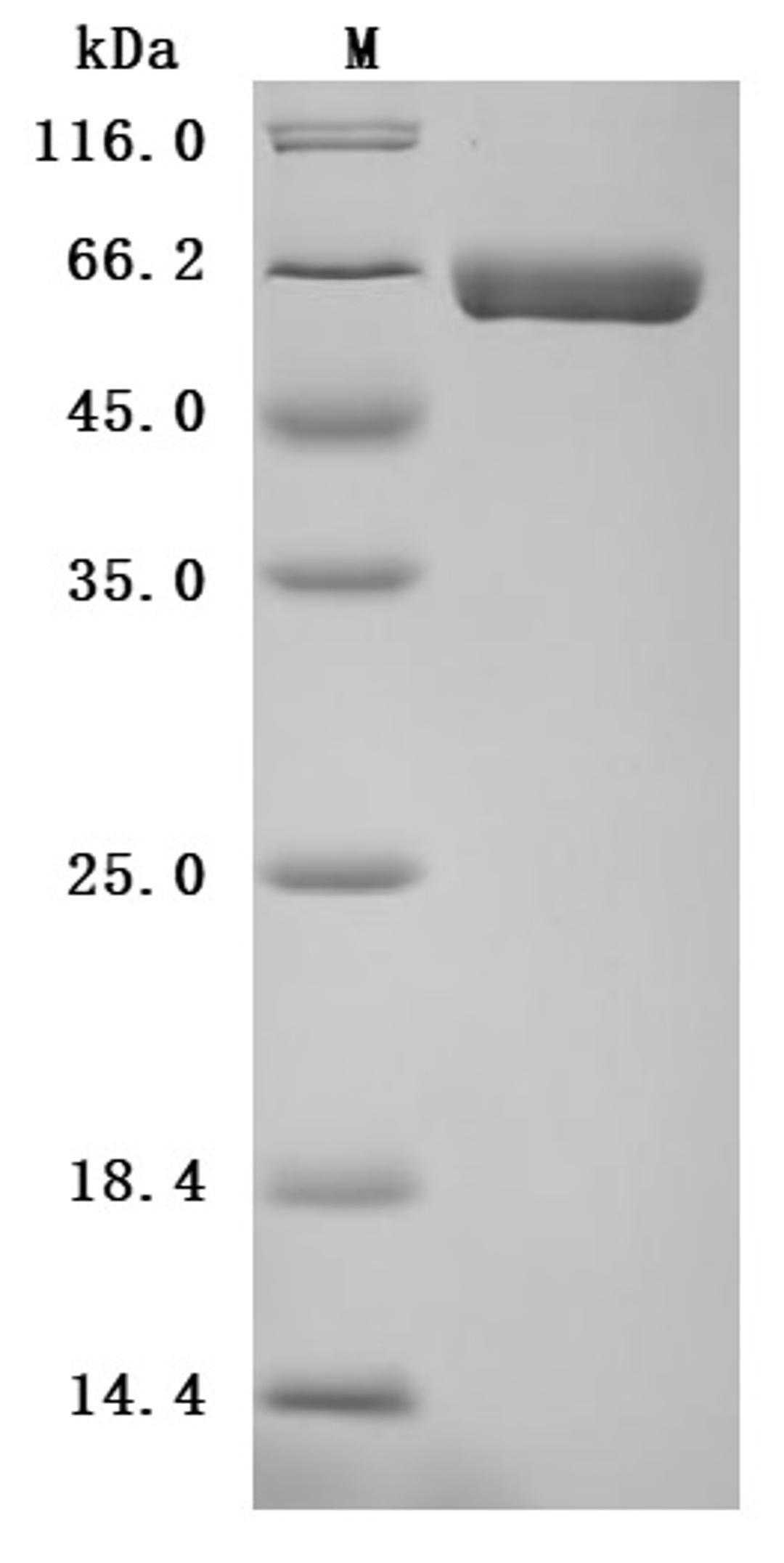 (Tris-Glycine gel) Discontinuous SDS-PAGE (reduced) with 5% enrichment gel and 15% separation gel.