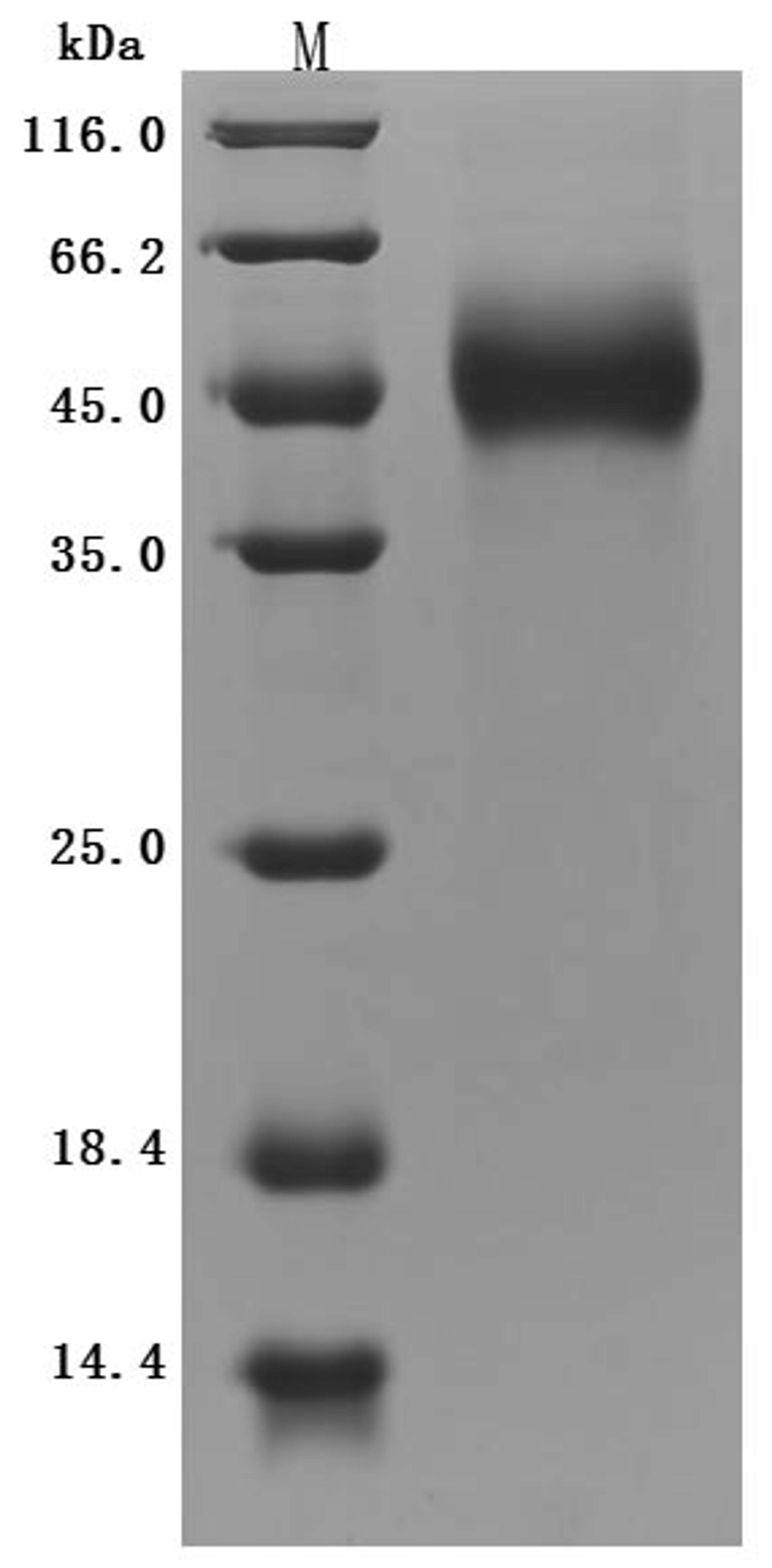 (Tris-Glycine gel) Discontinuous SDS-PAGE (reduced) with 5% enrichment gel and 15% separation gel.