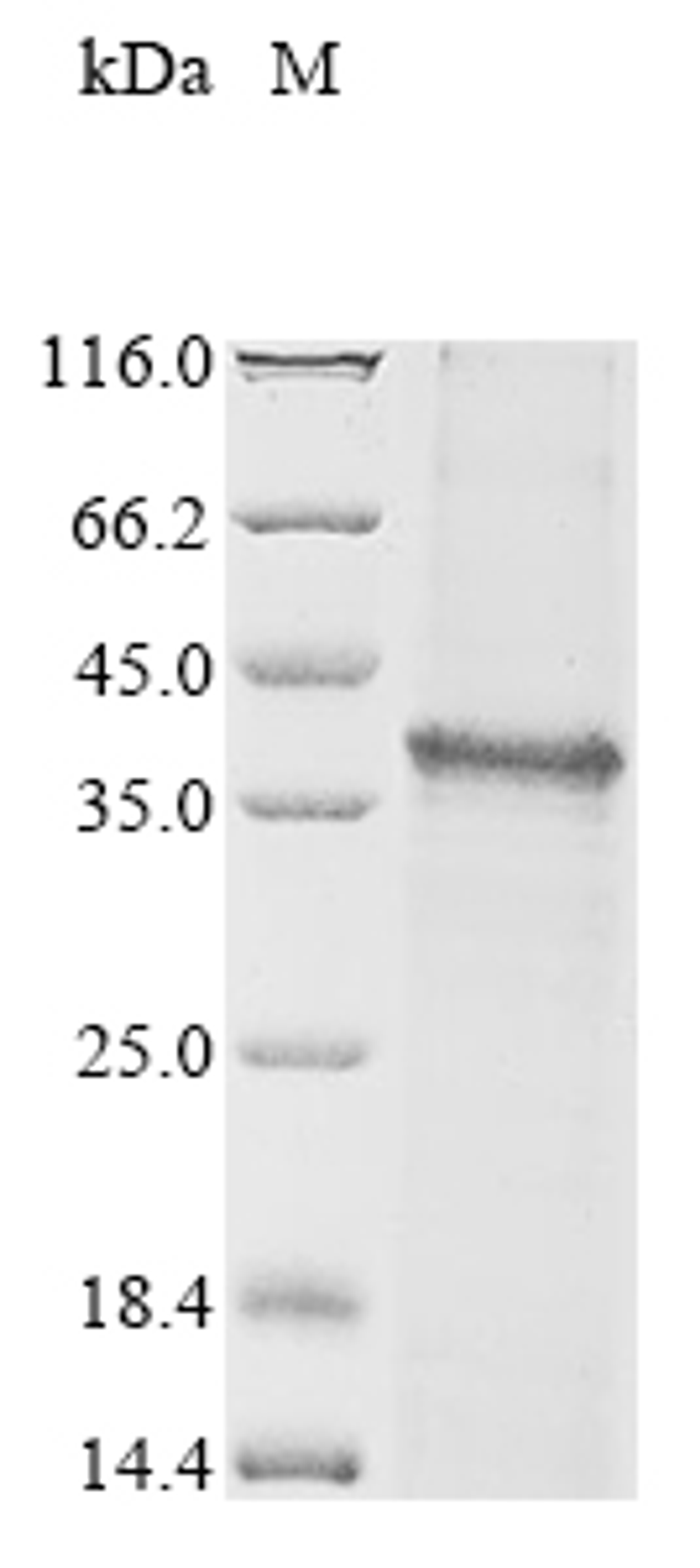 (Tris-Glycine gel) Discontinuous SDS-PAGE (reduced) with 5% enrichment gel and 15% separation gel.