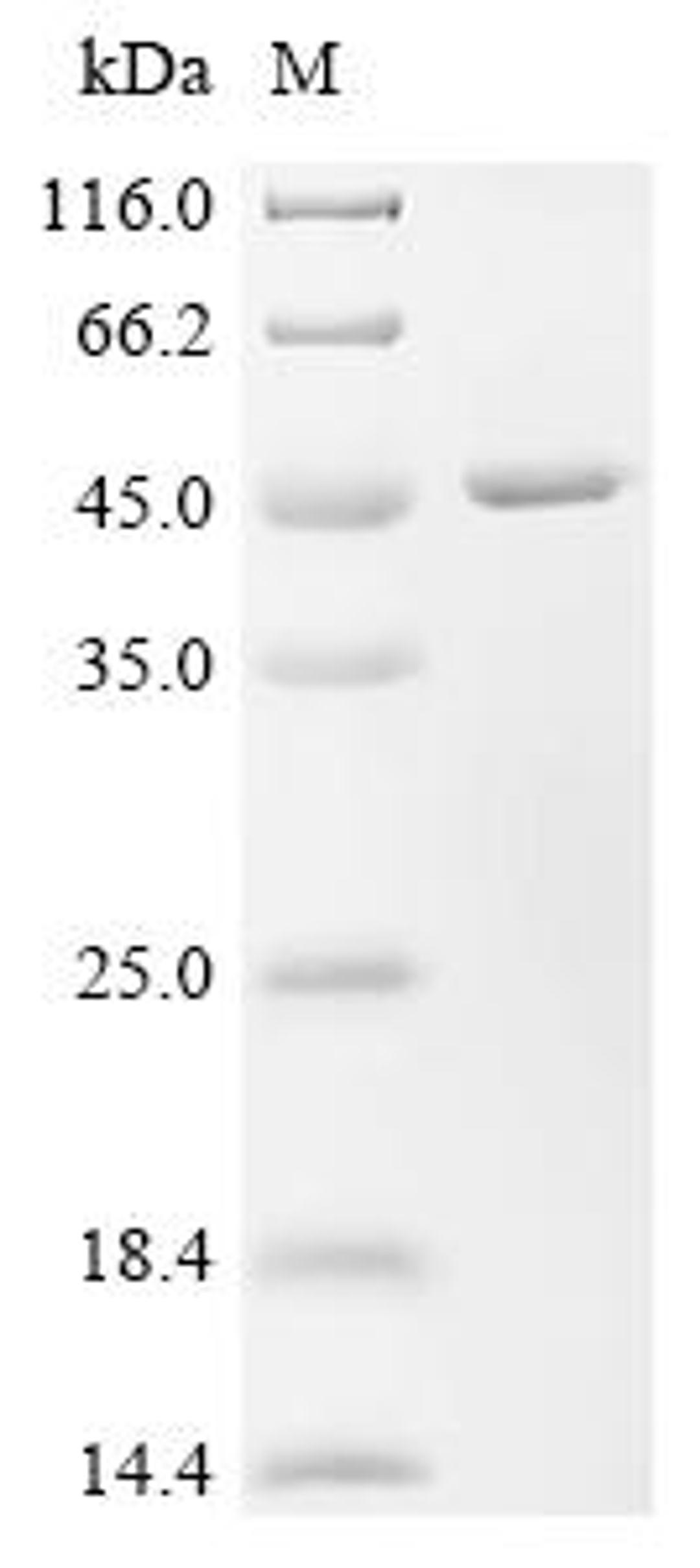 (Tris-Glycine gel) Discontinuous SDS-PAGE (reduced) with 5% enrichment gel and 15% separation gel.