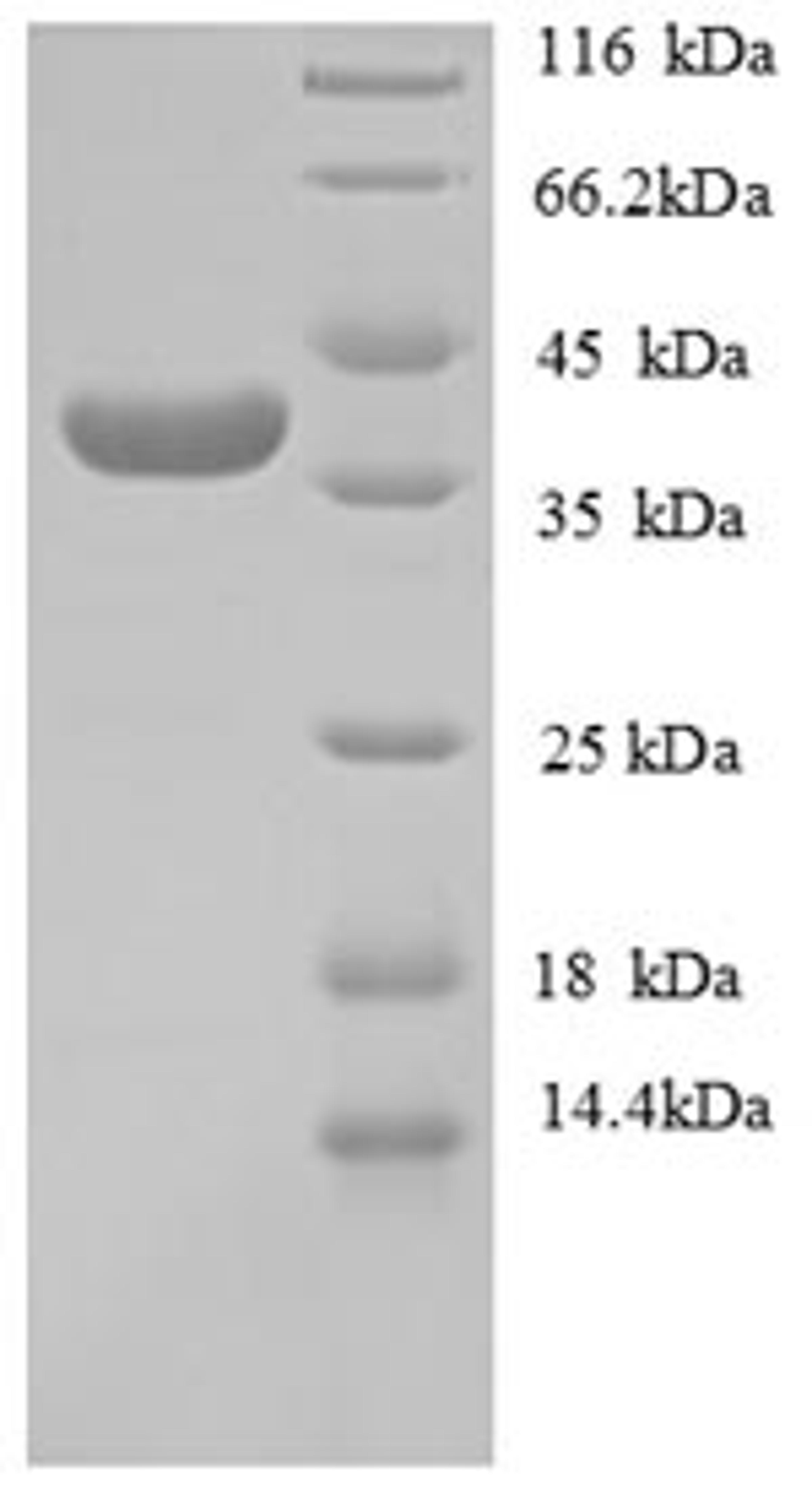 (Tris-Glycine gel) Discontinuous SDS-PAGE (reduced) with 5% enrichment gel and 15% separation gel.