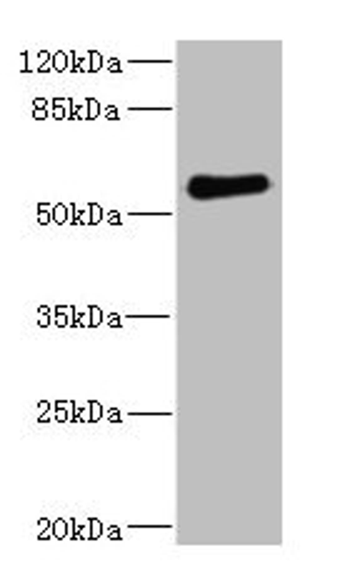 Western blot. All lanes: FCRL2 antibody at 1.78µg/ml + 293T whole cell lysate. Secondary. Goat polyclonal to rabbit IgG at 1/10000 dilution. Predicted band size: 56, 28, 21, 16, 23 kDa. Observed band size: 56 kDa