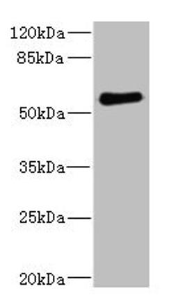Western blot. All lanes: FCRL2 antibody at 1.78µg/ml + 293T whole cell lysate. Secondary. Goat polyclonal to rabbit IgG at 1/10000 dilution. Predicted band size: 56, 28, 21, 16, 23 kDa. Observed band size: 56 kDa