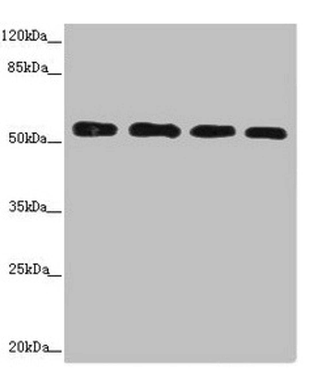Western blot. All lanes: CALCOCO2 antibody at 3.66ug/ml. Lane 1: Hela whole cell lysate. Lane 2: Jurkat whole cell lysate. Lane 3: 293T whole cell lysate. Lane 4: Raji whole cell lysate. Secondary. Goat polyclonal to rabbit IgG at 1/10000 dilution. Predicted band size: 53, 48, 55, 56, 44 kDa. Observed band size: 56 kDa.