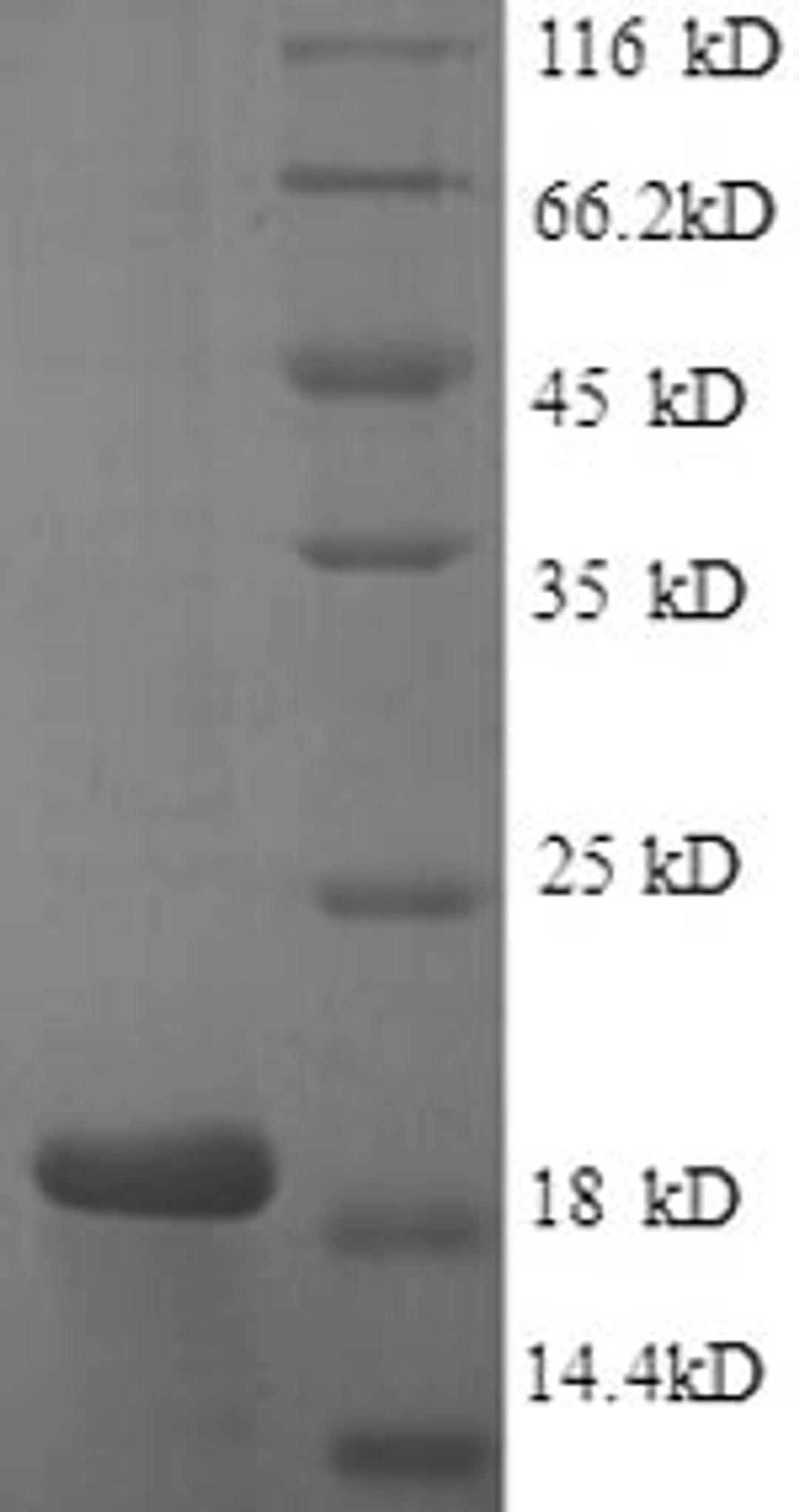 (Tris-Glycine gel) Discontinuous SDS-PAGE (reduced) with 5% enrichment gel and 15% separation gel.