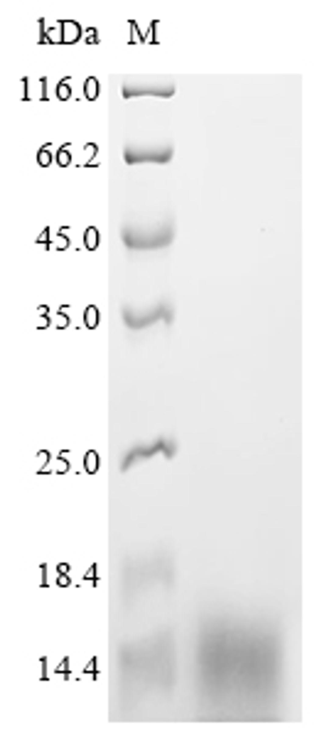 (Tris-Glycine gel) Discontinuous SDS-PAGE (reduced) with 5% enrichment gel and 15% separation gel.