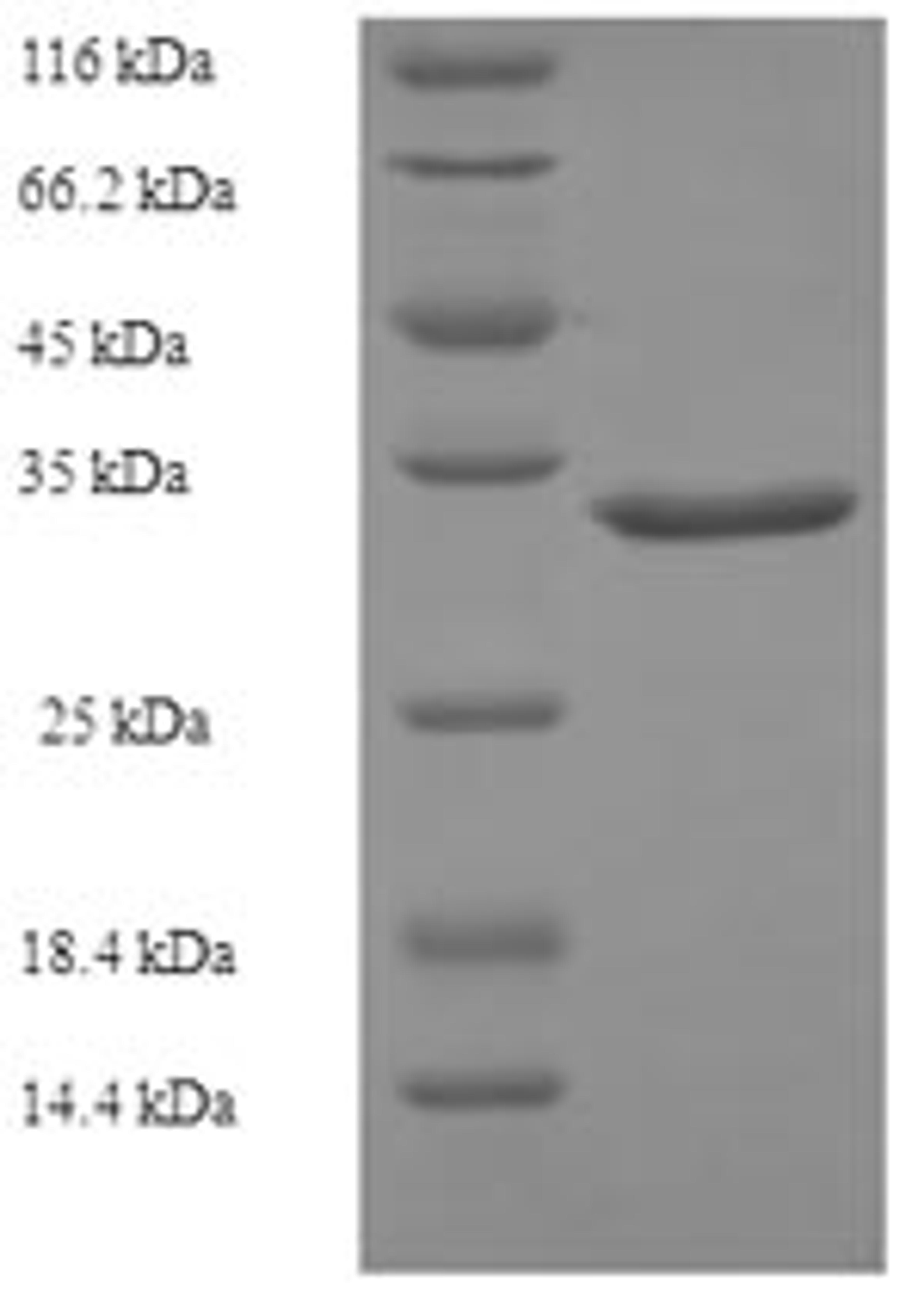 (Tris-Glycine gel) Discontinuous SDS-PAGE (reduced) with 5% enrichment gel and 15% separation gel.