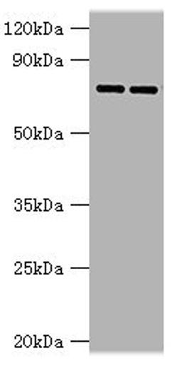 Western blot. All lanes: AGUSB antibody at 2ug/ml. Lane 1: HL60 whole cell lysate. Lane 2: HepG2 whole cell lysate. Secondary. Goat polyclonal to rabbit IgG at 1/10000 dilution. Predicted band size: 75, 70, 59 kDa. Observed band size: 75 kDa. 