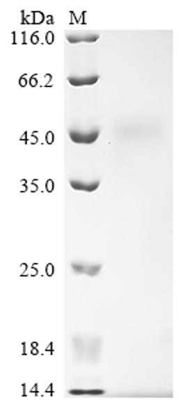 (Tris-Glycine gel) Discontinuous SDS-PAGE (reduced) with 5% enrichment gel and 15% separation gel.