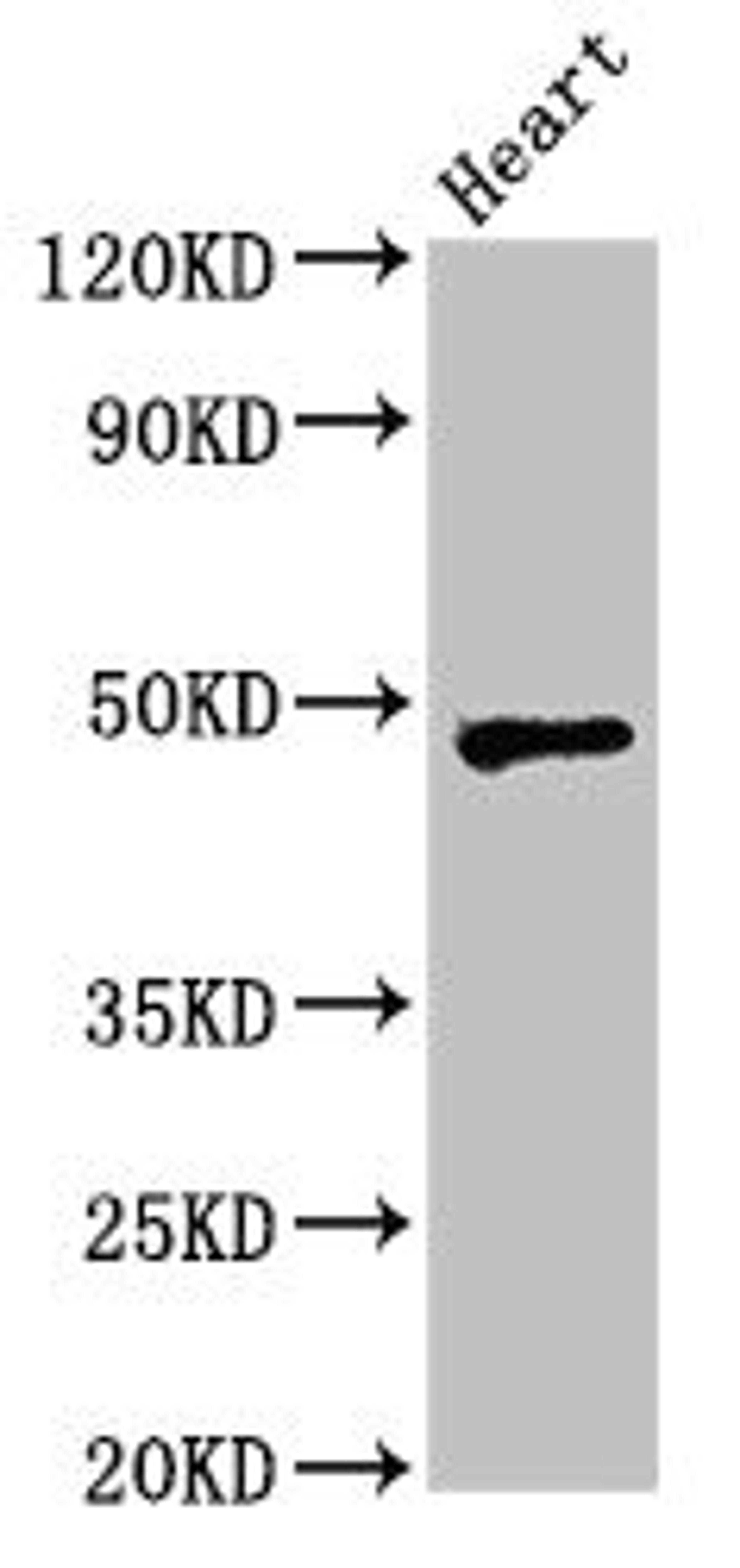 Western Blot. Positive WB detected in: Rat heart tissue. All lanes: WSB1 antibody at 2.5ug/ml. Secondary. Goat polyclonal to rabbit IgG at 1/50000 dilution. Predicted band size: 48, 31, 28, 25 kDa. Observed band size: 48 kDa. 