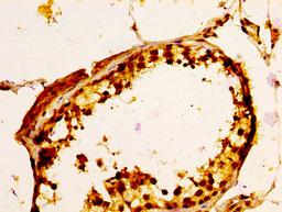 IHC image of CSB-PA887177LA01HU diluted at 1:100 and staining in paraffin-embedded human testis tissue performed on a Leica BondTM system. After dewaxing and hydration, antigen retrieval was mediated by high pressure in a citrate buffer (pH 6.0). Section was blocked with 10% normal goat serum 30min at RT. Then primary antibody (1% BSA) was incubated at 4&deg;C overnight. The primary is detected by a biotinylated secondary antibody and visualized using an HRP conjugated SP system.