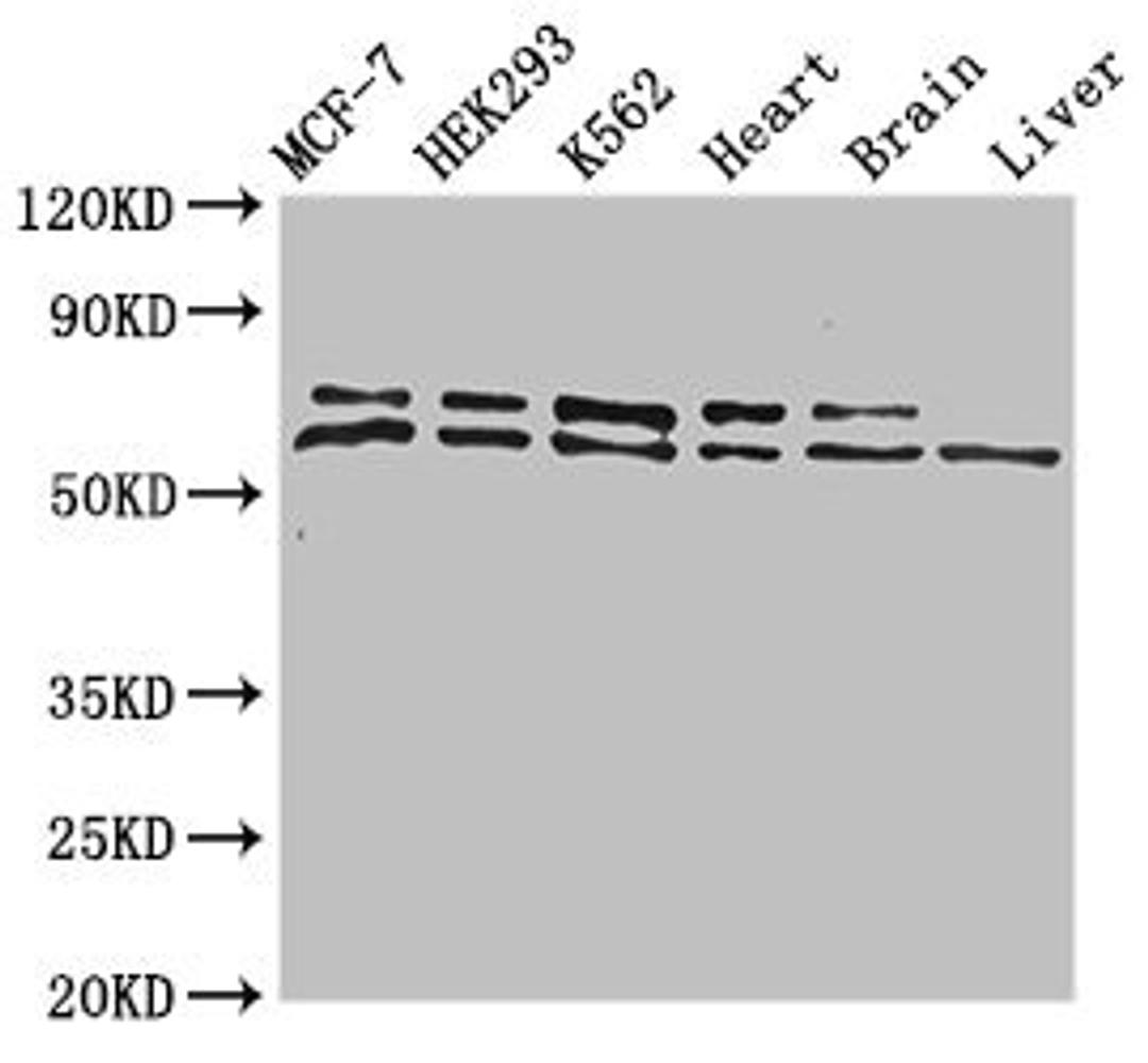 Western Blot. Positive WB detected in: MCF-7 whole cell lysate, HEK293 whole cell lysate, K562 whole cell lysate, Mouse heart tissue, Mouse brain tissue, Mouse liver tissue. All lanes: ACAD9 antibody at 1ug/ml. Secondary. Goat polyclonal to rabbit IgG at 1/50000 dilution. Predicted band size: 69 kDa. Observed band size: 69, 70 kDa. 