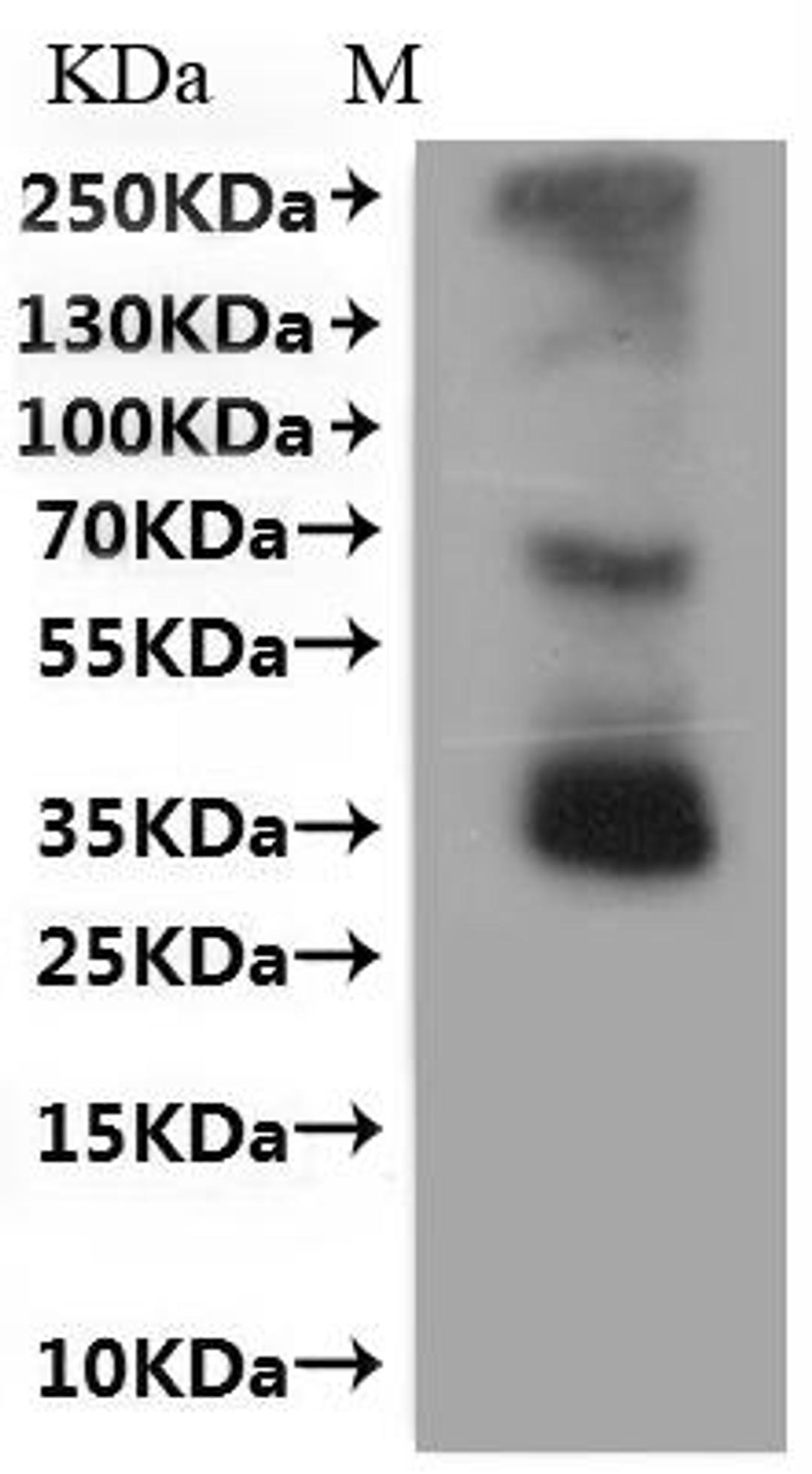 CSB-MP004847MO is detected by Mouse anti-6*His monoclonal antibody.