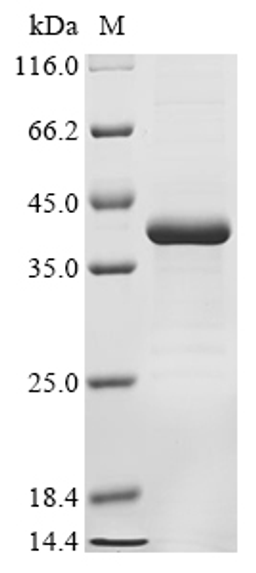 (Tris-Glycine gel) Discontinuous SDS-PAGE (reduced) with 5% enrichment gel and 15% separation gel.