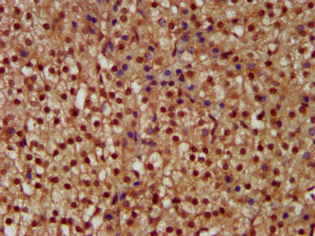 IHC image of CSB-PA836281LA01HU diluted at 1:300 and staining in paraffin-embedded human adrenal gland tissue performed on a Leica BondTM system. After dewaxing and hydration, antigen retrieval was mediated by high pressure in a citrate buffer (pH 6.0). Section was blocked with 10% normal goat serum 30min at RT. Then primary antibody (1% BSA) was incubated at 4&deg;C overnight. The primary is detected by a biotinylated secondary antibody and visualized using an HRP conjugated SP system.