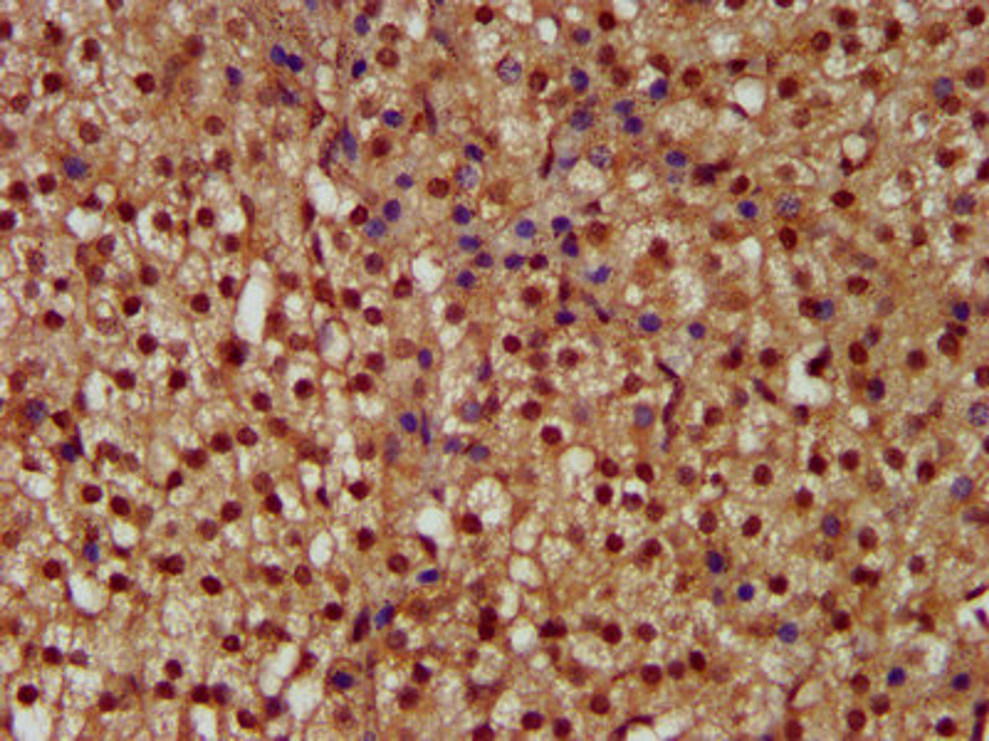IHC image of CSB-PA836281LA01HU diluted at 1:300 and staining in paraffin-embedded human adrenal gland tissue performed on a Leica BondTM system. After dewaxing and hydration, antigen retrieval was mediated by high pressure in a citrate buffer (pH 6.0). Section was blocked with 10% normal goat serum 30min at RT. Then primary antibody (1% BSA) was incubated at 4&deg;C overnight. The primary is detected by a biotinylated secondary antibody and visualized using an HRP conjugated SP system.