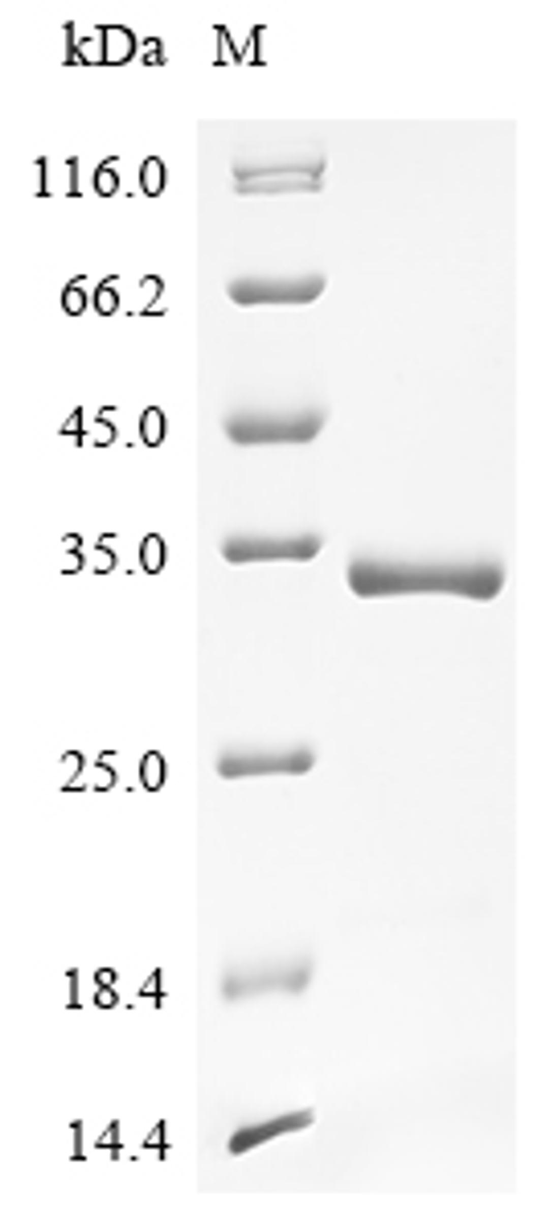 (Tris-Glycine gel) Discontinuous SDS-PAGE (reduced) with 5% enrichment gel and 15% separation gel.