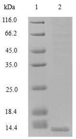(Tris-Glycine gel) Discontinuous SDS-PAGE (reduced) with 5% enrichment gel and 15% separation gel.