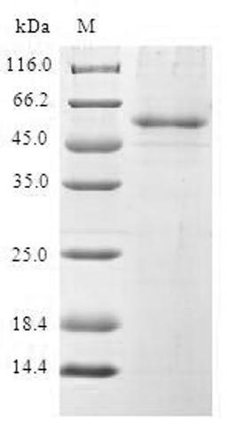 (Tris-Glycine gel) Discontinuous SDS-PAGE (reduced) with 5% enrichment gel and 15% separation gel.