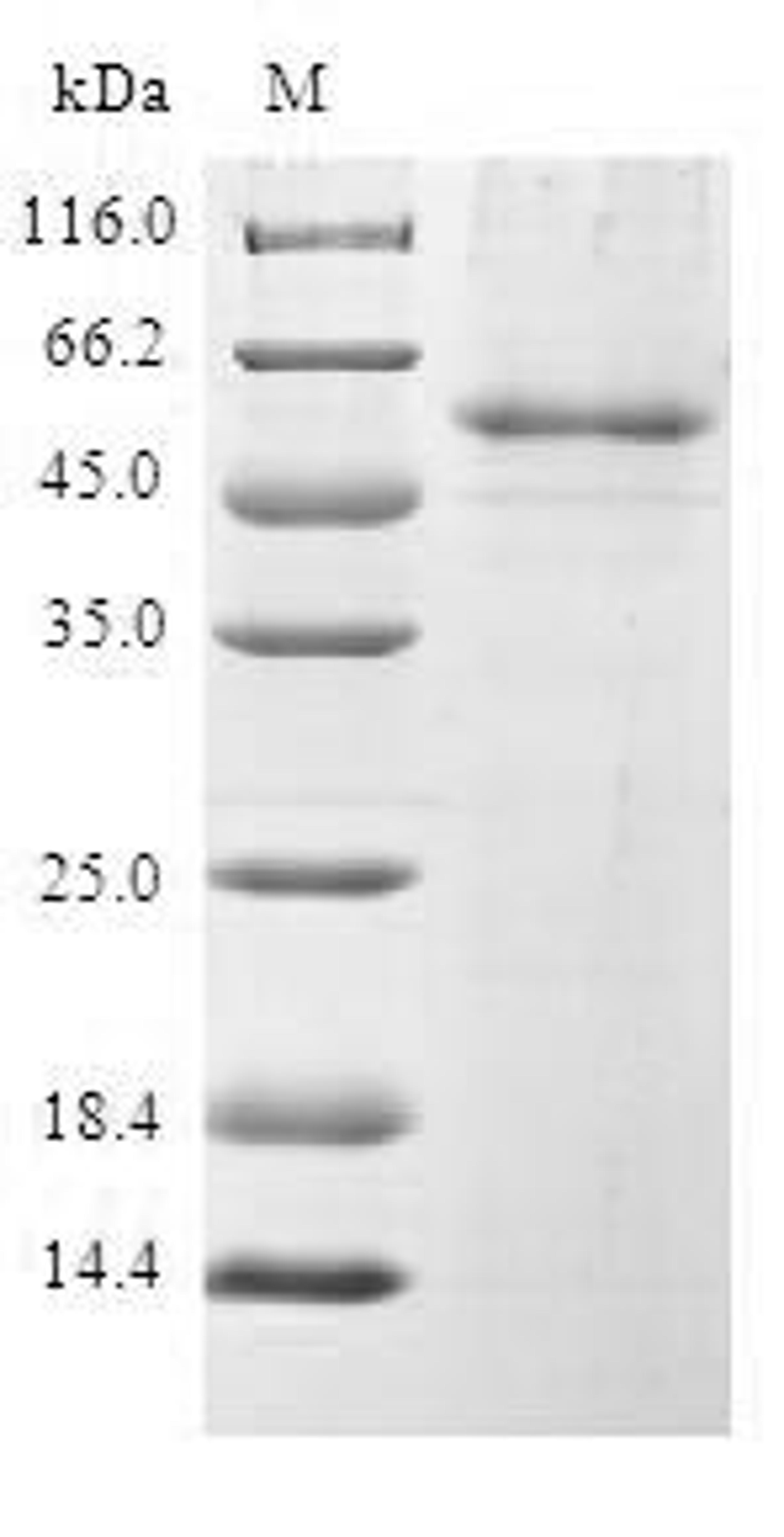 (Tris-Glycine gel) Discontinuous SDS-PAGE (reduced) with 5% enrichment gel and 15% separation gel.