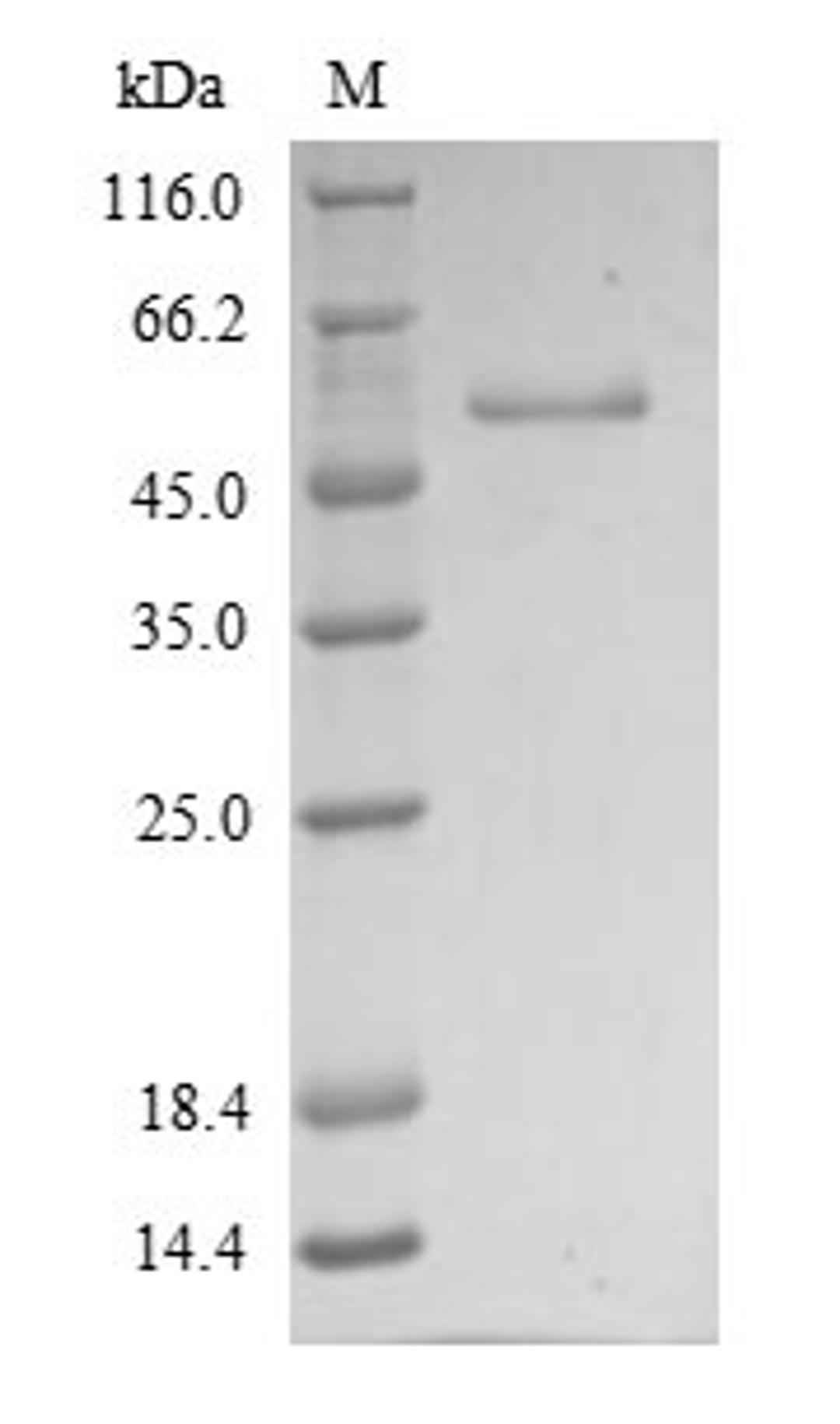 (Tris-Glycine gel) Discontinuous SDS-PAGE (reduced) with 5% enrichment gel and 15% separation gel.