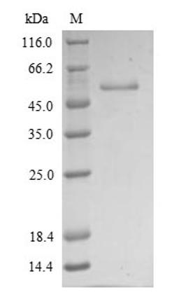 (Tris-Glycine gel) Discontinuous SDS-PAGE (reduced) with 5% enrichment gel and 15% separation gel.