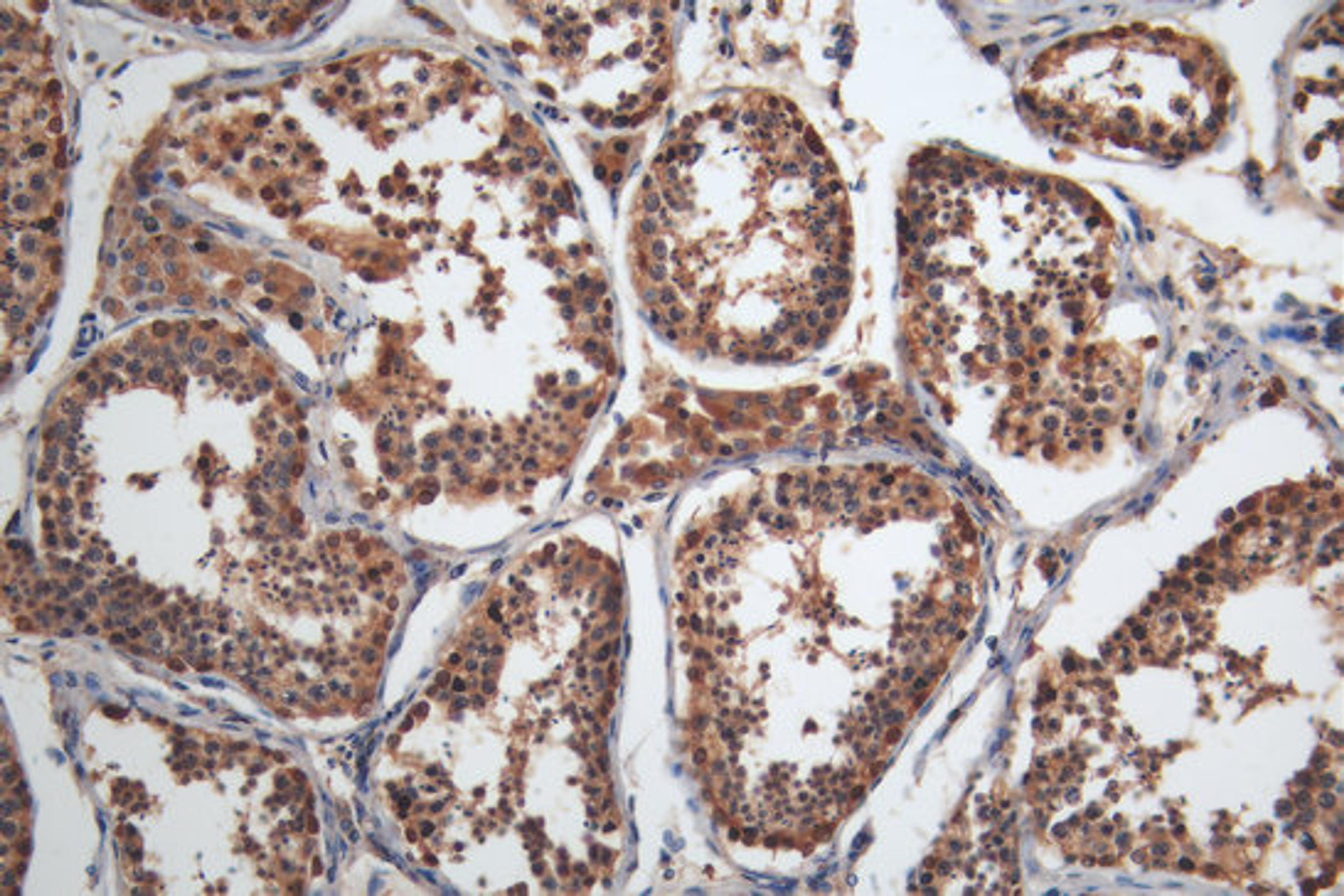 IHC image of CSB-MA013330A0m diluted at 1:200 and staining in paraffin-embedded human testis tissue performed on a Leica BondTM system. After dewaxing and hydration, antigen retrieval was mediated by high pressure in a citrate buffer (pH 6.0). Section was blocked with 10% normal goat serum 30min at RT. Then primary antibody (1% BSA) was incubated at 4°C overnight. The primary is detected by a Goat anti-mouse polymer IgG labeled by HRP and visualized using 0.05% DAB.
