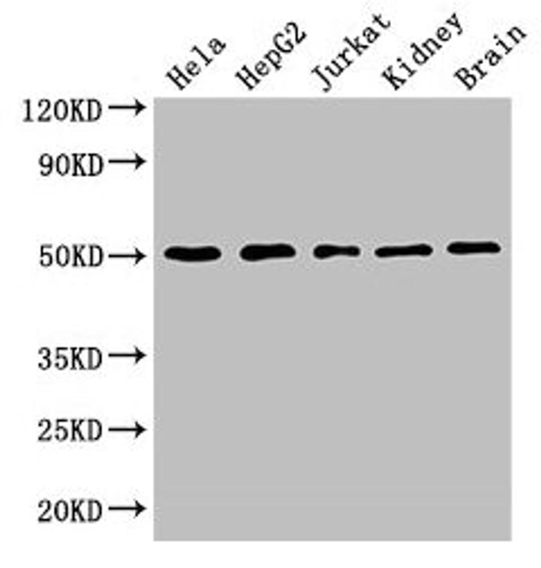 Western Blot. Positive WB detected in: Hela whole cell lysate, HepG2 whole cell lysate, Jurkat whole cell lysate, Mouse kidney tissue, Mouse brain tissue. All lanes: TUBA3C antibody at 3µg/ml. Secondary. Goat polyclonal to rabbit IgG at 1/50000 dilution. Predicted band size: 50, 47 kDa. Observed band size: 50 kDa