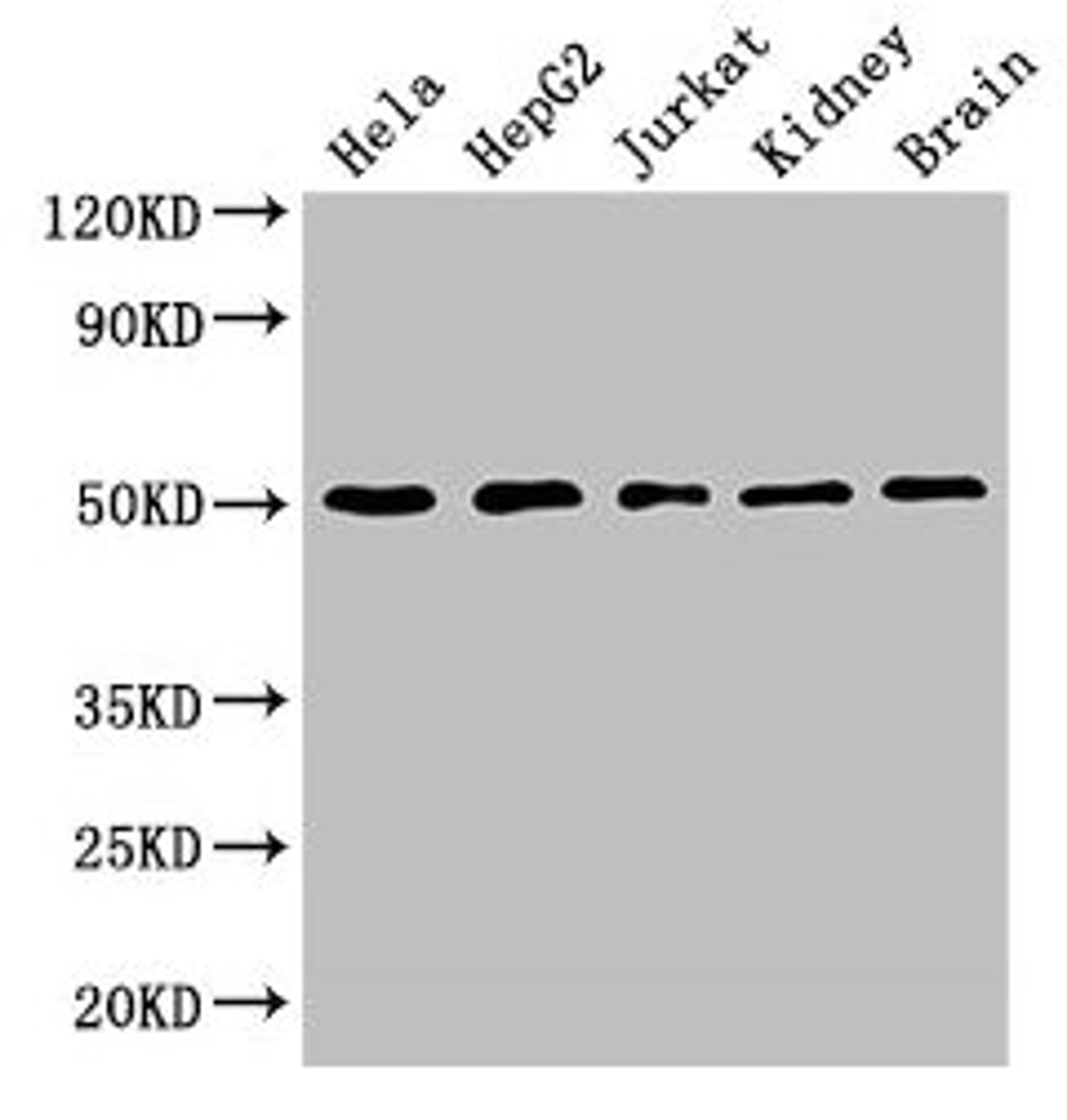 Western Blot. Positive WB detected in: Hela whole cell lysate, HepG2 whole cell lysate, Jurkat whole cell lysate, Mouse kidney tissue, Mouse brain tissue. All lanes: TUBA3C antibody at 3µg/ml. Secondary. Goat polyclonal to rabbit IgG at 1/50000 dilution. Predicted band size: 50, 47 kDa. Observed band size: 50 kDa