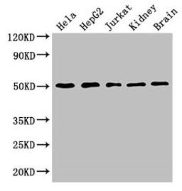 Western Blot. Positive WB detected in: Hela whole cell lysate, HepG2 whole cell lysate, Jurkat whole cell lysate, Mouse kidney tissue, Mouse brain tissue. All lanes: TUBA3C antibody at 3µg/ml. Secondary. Goat polyclonal to rabbit IgG at 1/50000 dilution. Predicted band size: 50, 47 kDa. Observed band size: 50 kDa