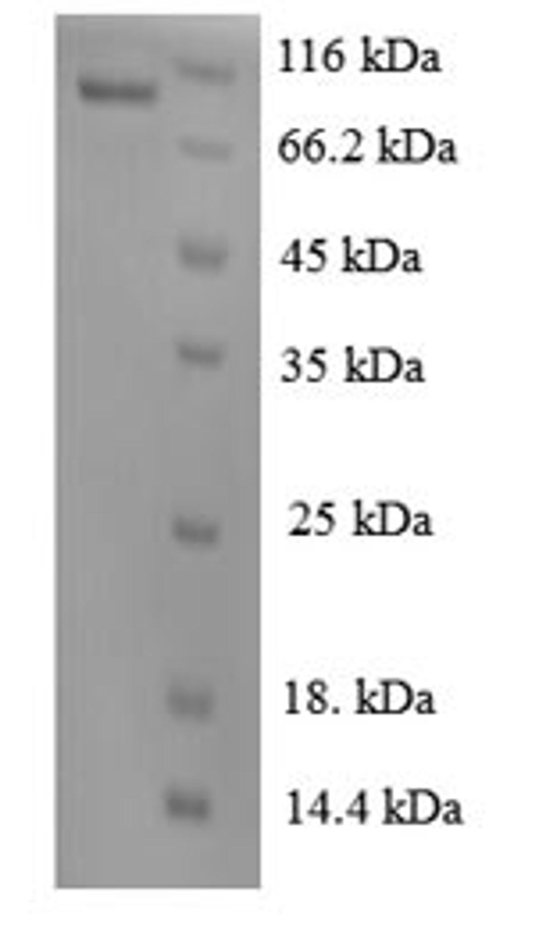 (Tris-Glycine gel) Discontinuous SDS-PAGE (reduced) with 5% enrichment gel and 15% separation gel.