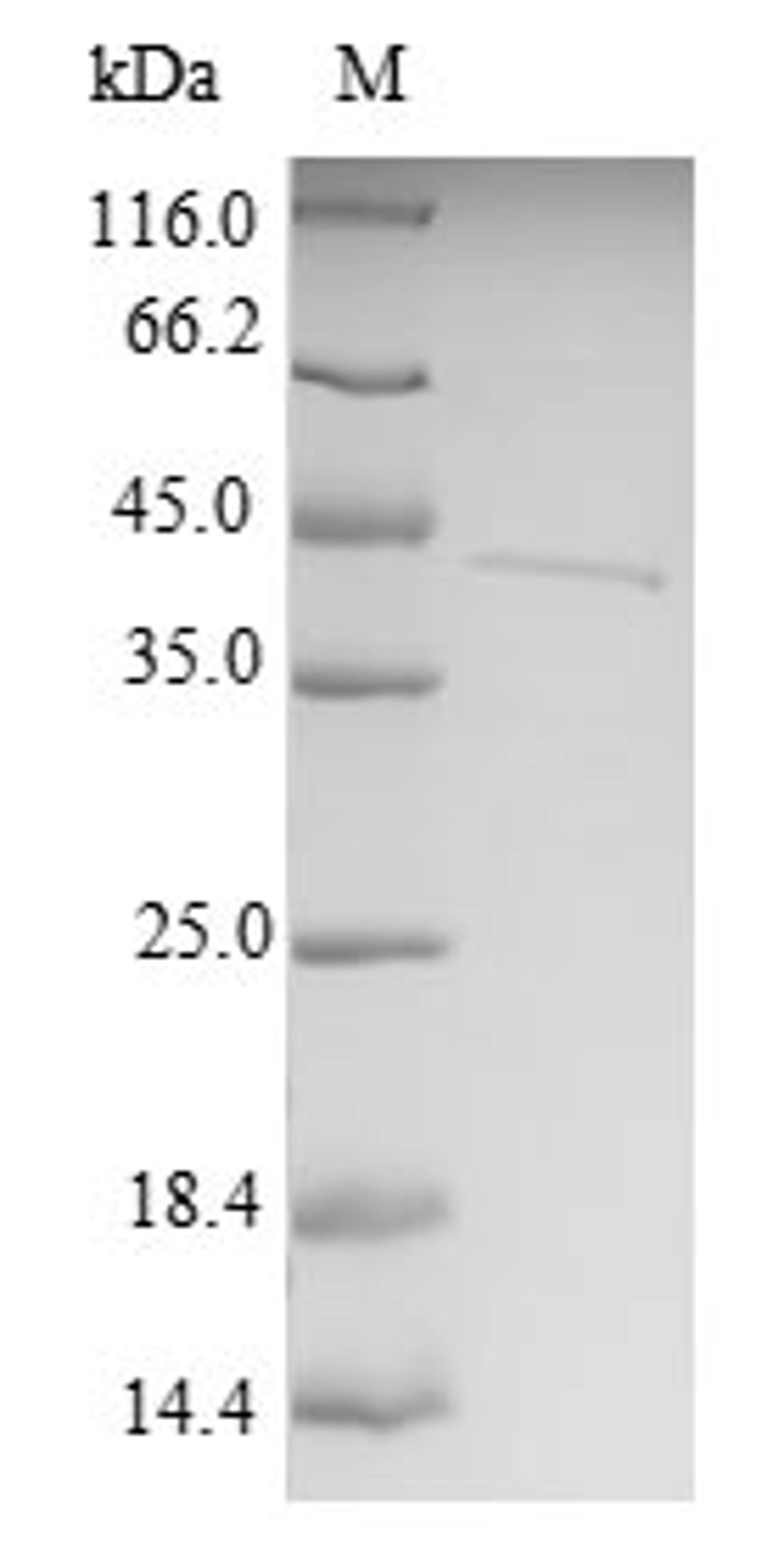 (Tris-Glycine gel) Discontinuous SDS-PAGE (reduced) with 5% enrichment gel and 15% separation gel.