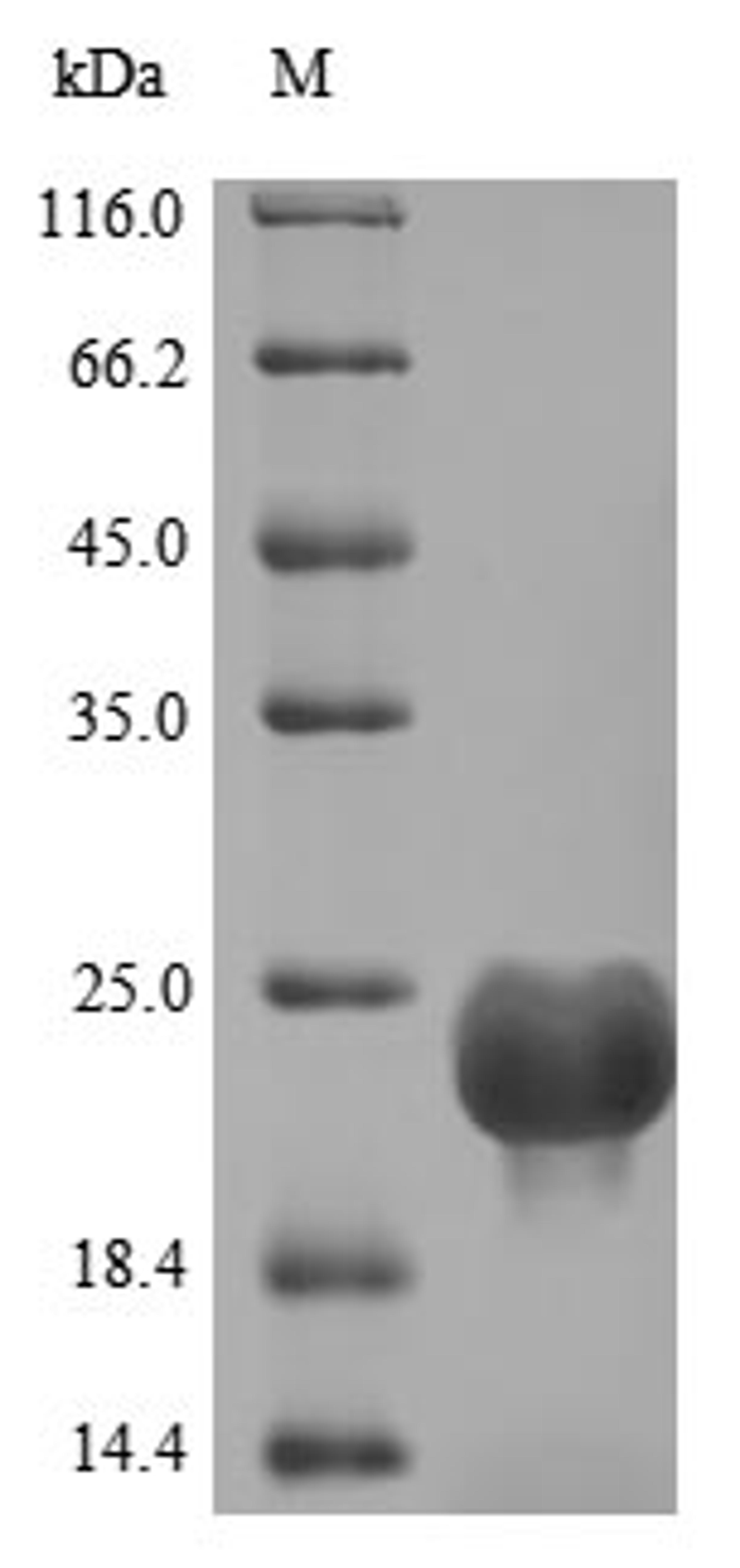 (Tris-Glycine gel) Discontinuous SDS-PAGE (reduced) with 5% enrichment gel and 15% separation gel.