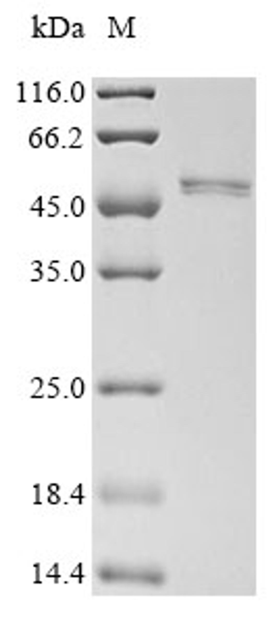 (Tris-Glycine gel) Discontinuous SDS-PAGE (reduced) with 5% enrichment gel and 15% separation gel.