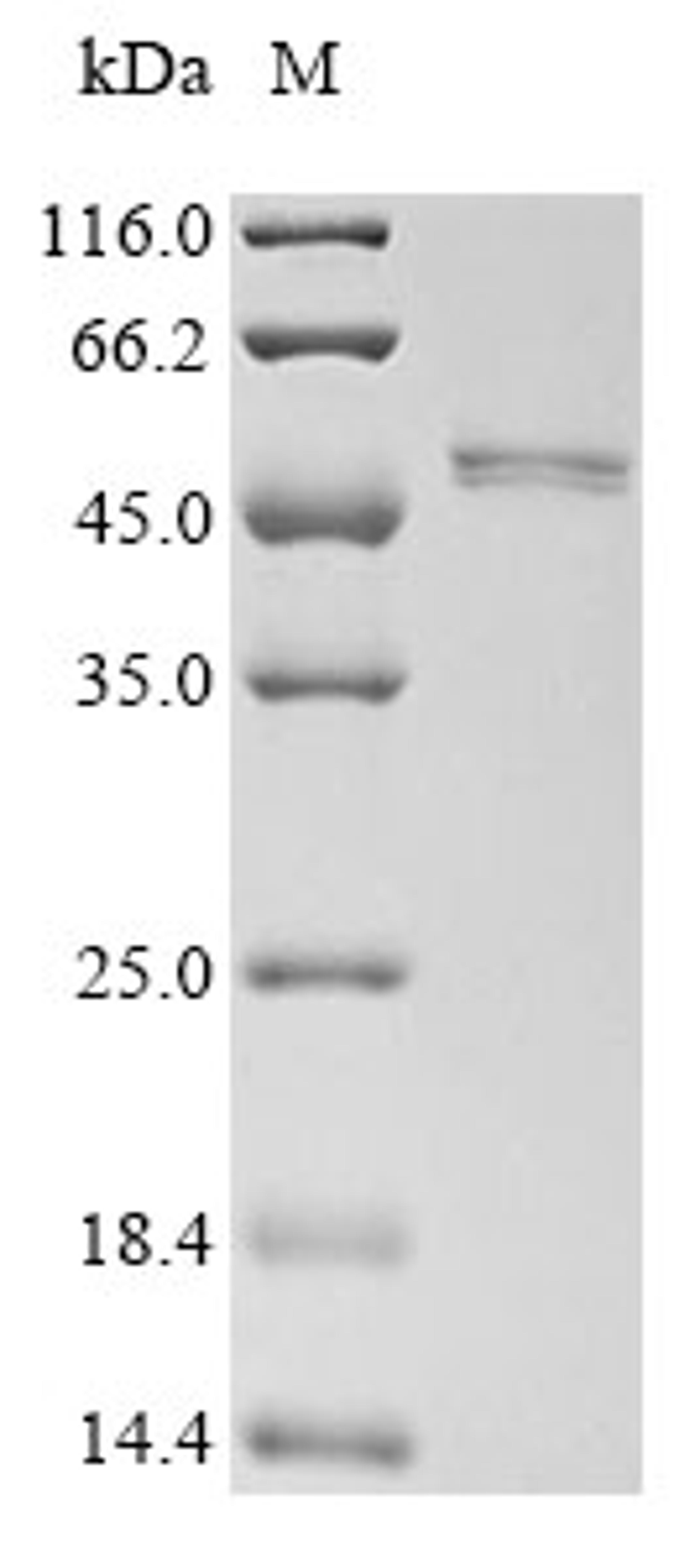 (Tris-Glycine gel) Discontinuous SDS-PAGE (reduced) with 5% enrichment gel and 15% separation gel.