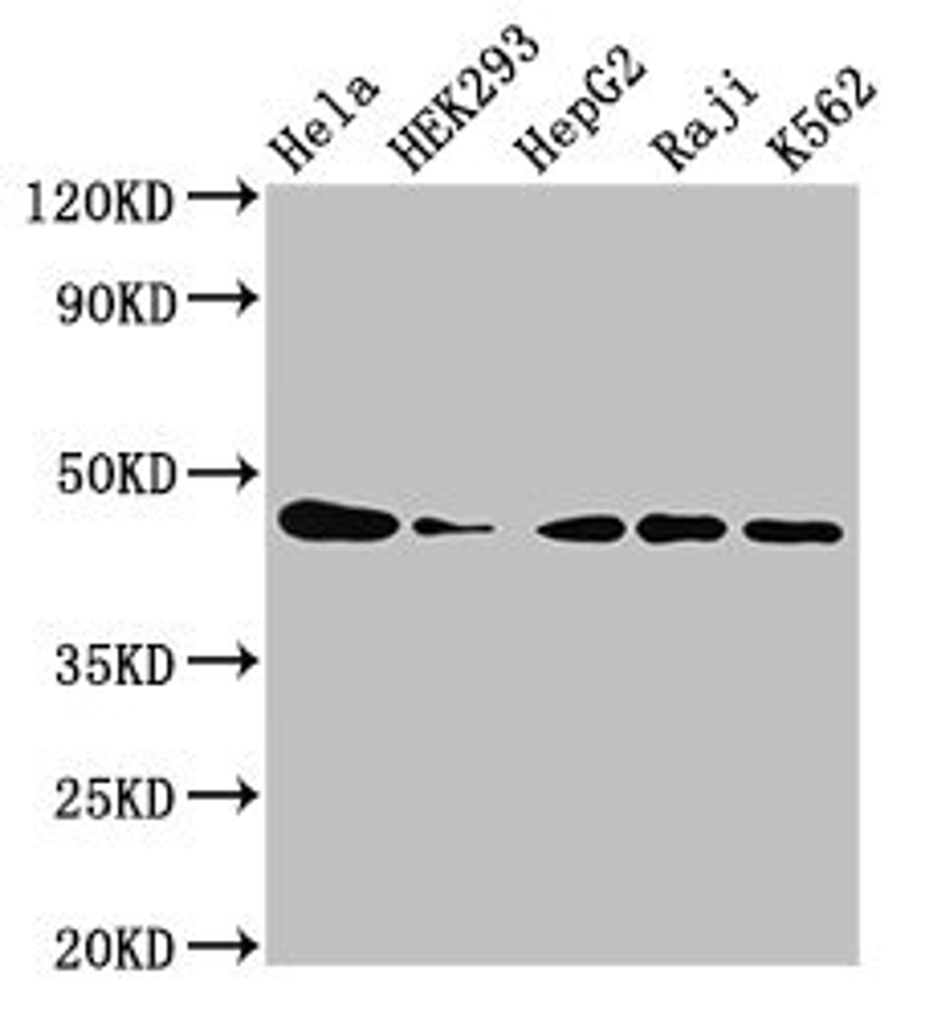 Western Blot. Positive WB detected in: Hela whole cell lysate, HEK293 whole cell lysate, HepG2 whole cell lysate, Raji whole cell lysate, K562 whole cell lysate. All lanes: CSNK2A1 antibody at 3µg/ml. Secondary. Goat polyclonal to rabbit IgG at 1/50000 dilution. Predicted band size: 46, 30 kDa. Observed band size: 46 kDa