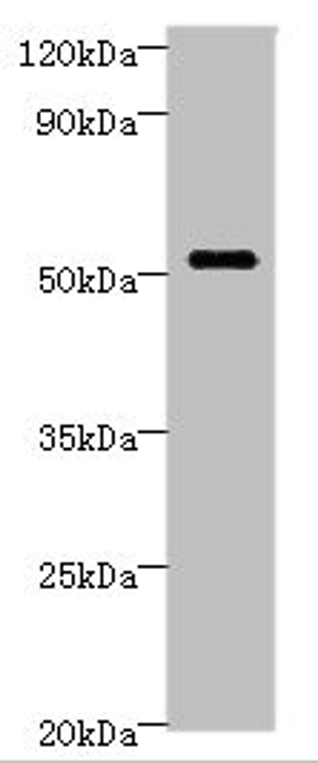 Western blot. All lanes: STARD3 Antibody at 6ug/ml + MCF-7 whole cell lysate. Secondary. Goat polyclonal to rabbit IgG at 1/10000 dilution. Predicted band size: 51, 49, 50 kDa. Observed band size: 51 kDa. 