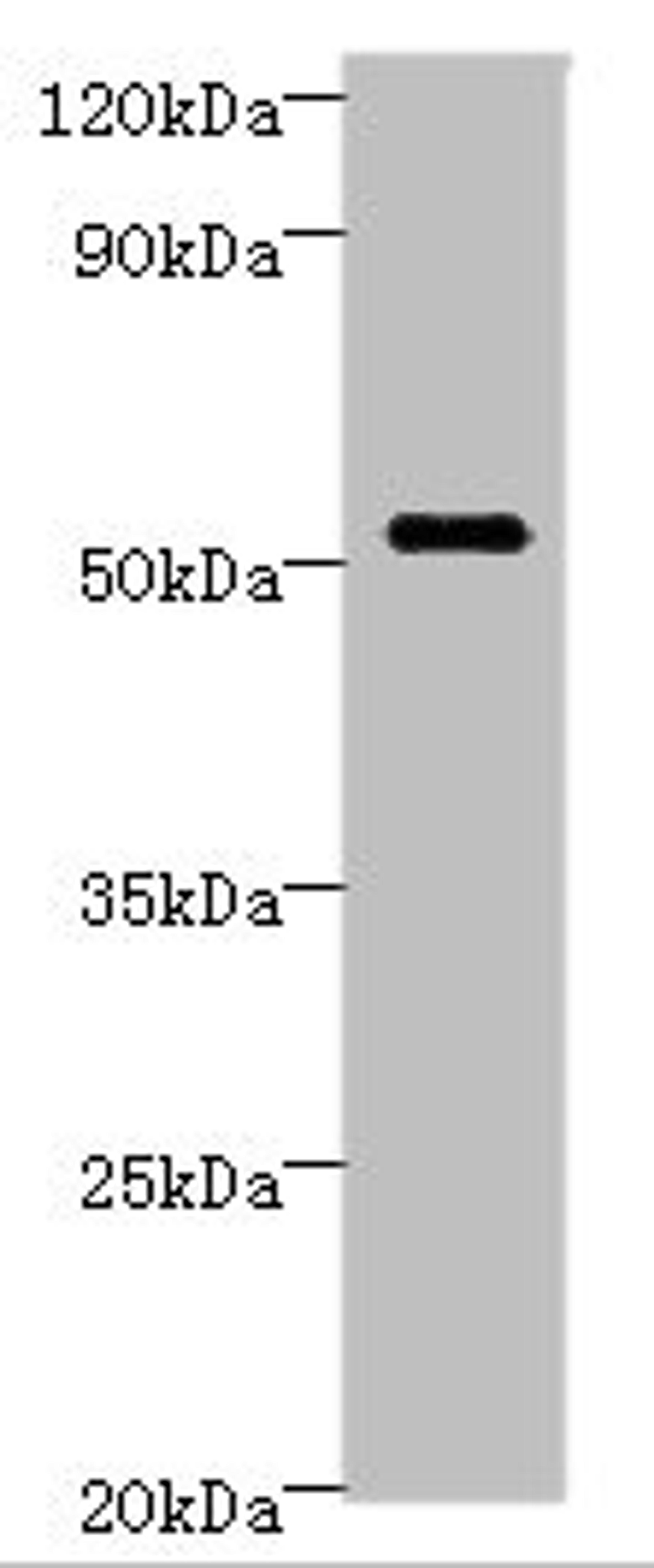 Western blot. All lanes: STARD3 Antibody at 6ug/ml + MCF-7 whole cell lysate. Secondary. Goat polyclonal to rabbit IgG at 1/10000 dilution. Predicted band size: 51, 49, 50 kDa. Observed band size: 51 kDa. 