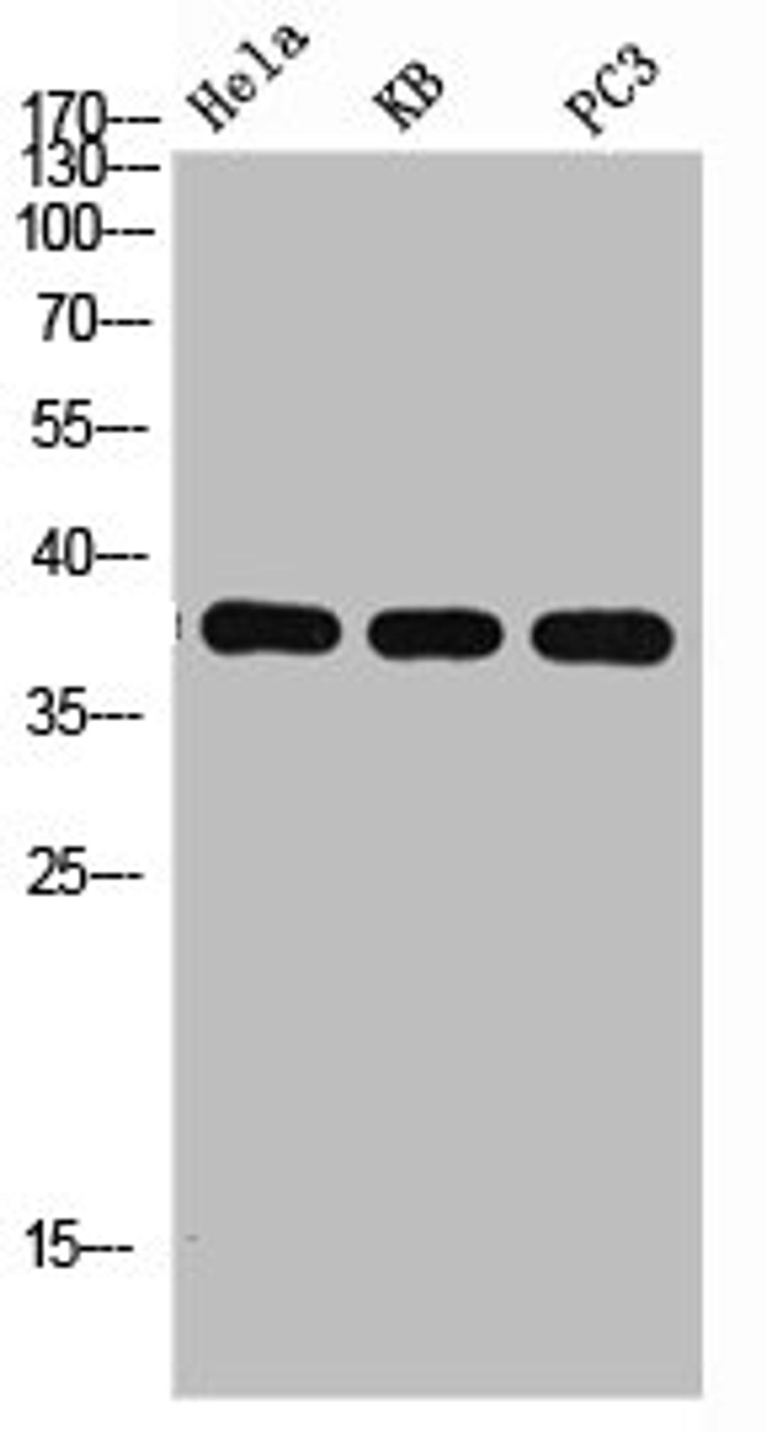 Western Blot analysis of HELA KB PC-3 using p38 Polyclonal Antibody. Antibody was diluted at 1:1000. Secondary antibody  was diluted at 1:20000