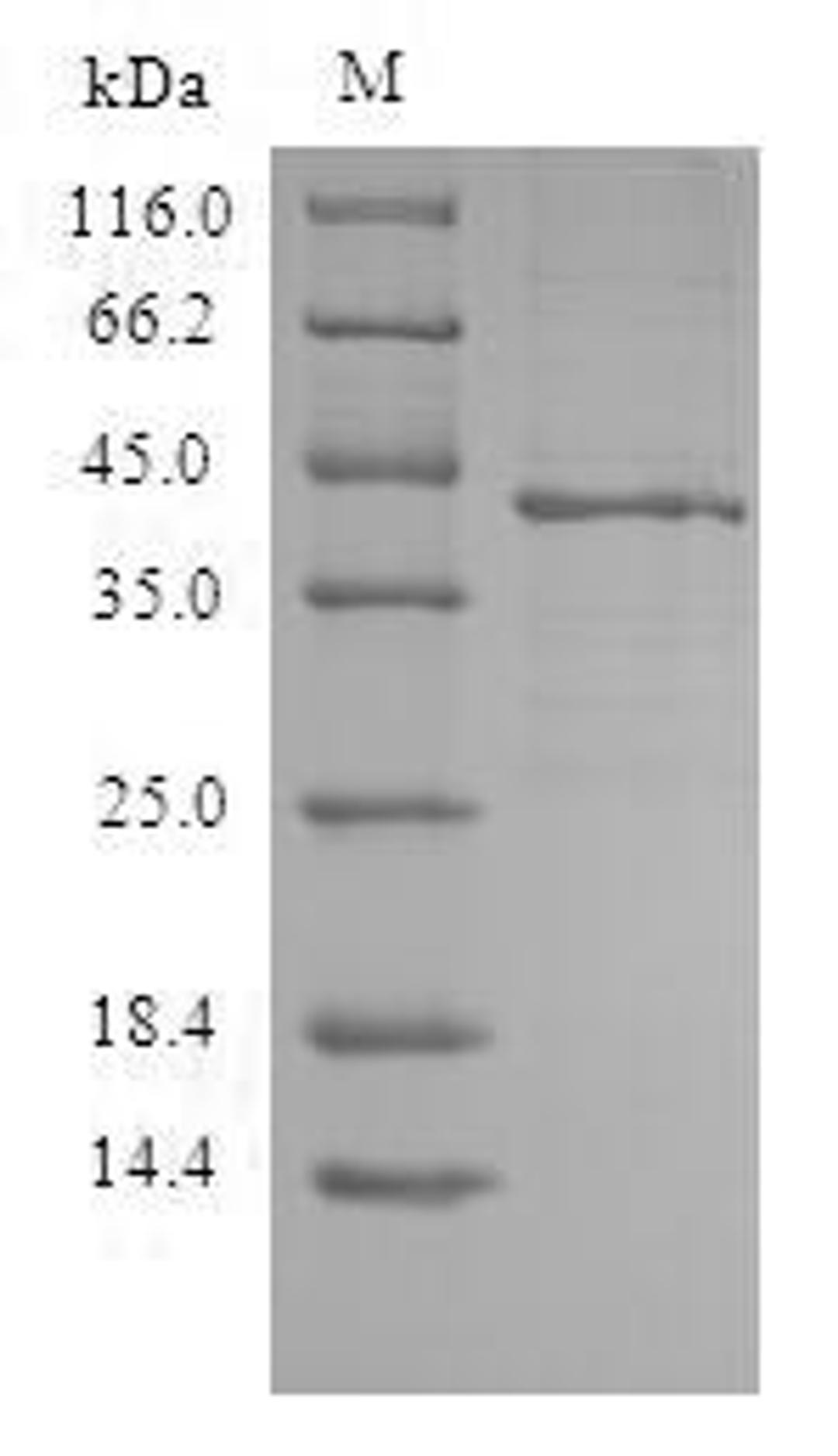 (Tris-Glycine gel) Discontinuous SDS-PAGE (reduced) with 5% enrichment gel and 15% separation gel.