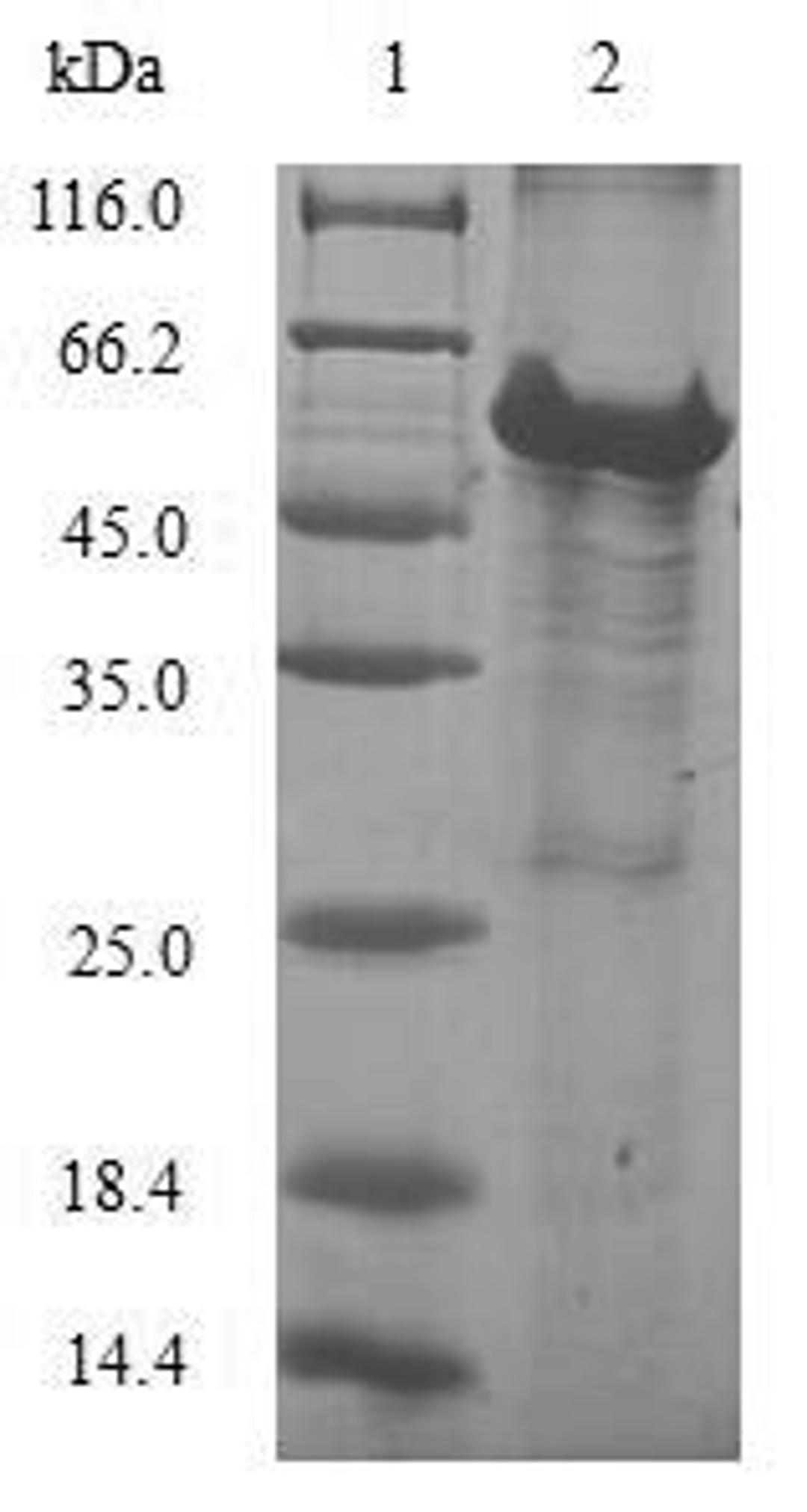 (Tris-Glycine gel) Discontinuous SDS-PAGE (reduced) with 5% enrichment gel and 15% separation gel.