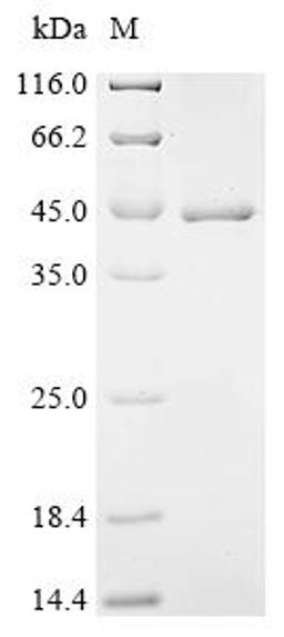(Tris-Glycine gel) Discontinuous SDS-PAGE (reduced) with 5% enrichment gel and 15% separation gel.