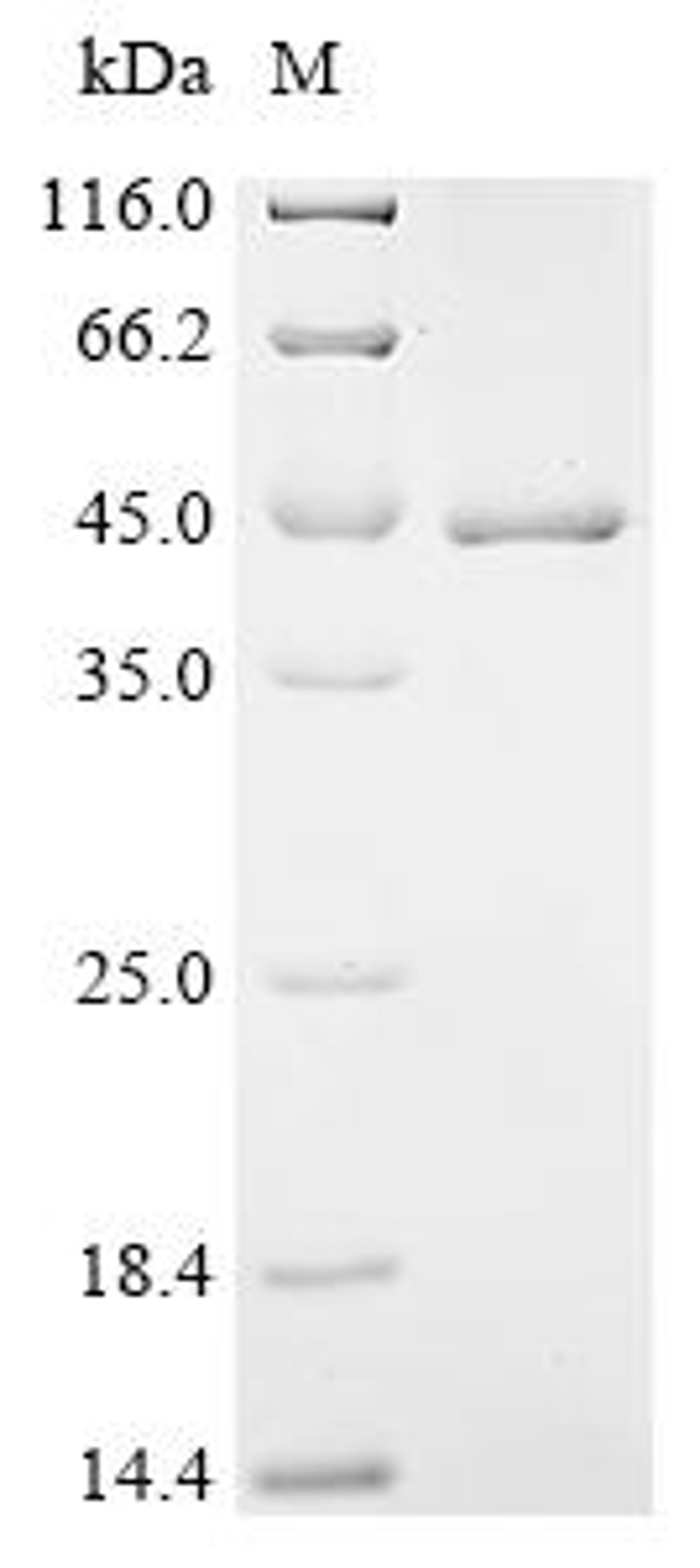 (Tris-Glycine gel) Discontinuous SDS-PAGE (reduced) with 5% enrichment gel and 15% separation gel.