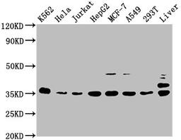 Western Blot. Positive WB detected in: K562 whole cell lysate, Hela whole cell lysate, Jurkat whole cell lysate, HepG2 whole cell lysate, MCF-7 whole cell lysate, A549 whole cell lysate, 293T whole cell lysate, Rat liver tissue. All lanes: PSMD14 antibody at 1:2000. Secondary. Goat polyclonal to rabbit IgG at 1/50000 dilution. Predicted band size: 35 kDa. Observed band size: 35 kDa