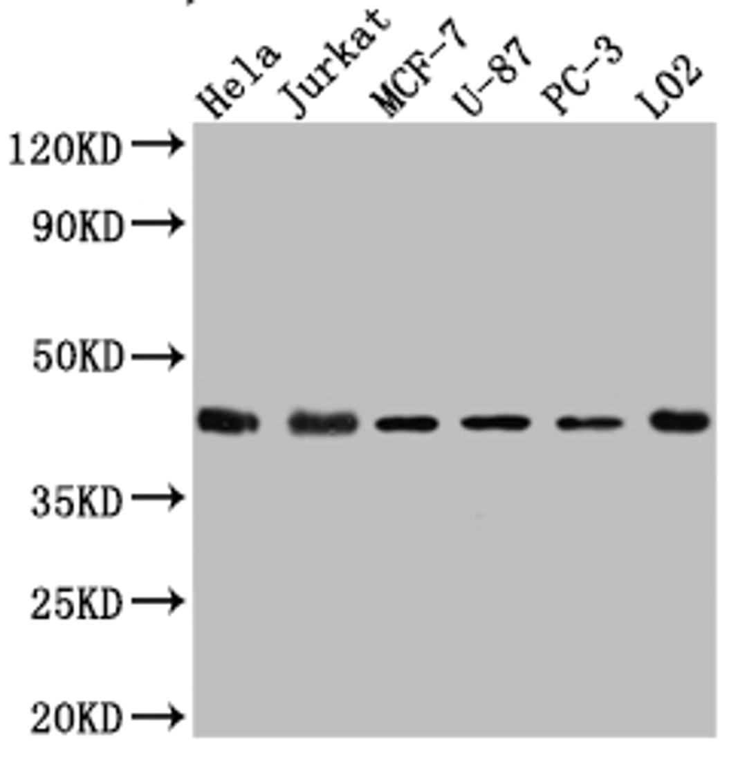 Western Blot. Positive WB detected in: Hela whole cell lysate, Jurkat whole cell lysate, MCF-7 whole cell lysate, U-87 whole cell lysate, PC-3 whole cell lysate, L02 whole cell lysate. All lanes: p38 antibody at 1:1000. Secondary. Goat polyclonal to rabbit IgG at 1/50000 dilution. Predicted band size: 42, 42, 35, 36, 30 kDa. Observed band size: 42 kDa. 