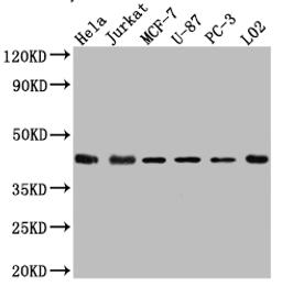 Western Blot. Positive WB detected in: Hela whole cell lysate, Jurkat whole cell lysate, MCF-7 whole cell lysate, U-87 whole cell lysate, PC-3 whole cell lysate, L02 whole cell lysate. All lanes: p38 antibody at 1:1000. Secondary. Goat polyclonal to rabbit IgG at 1/50000 dilution. Predicted band size: 42, 42, 35, 36, 30 kDa. Observed band size: 42 kDa. 
