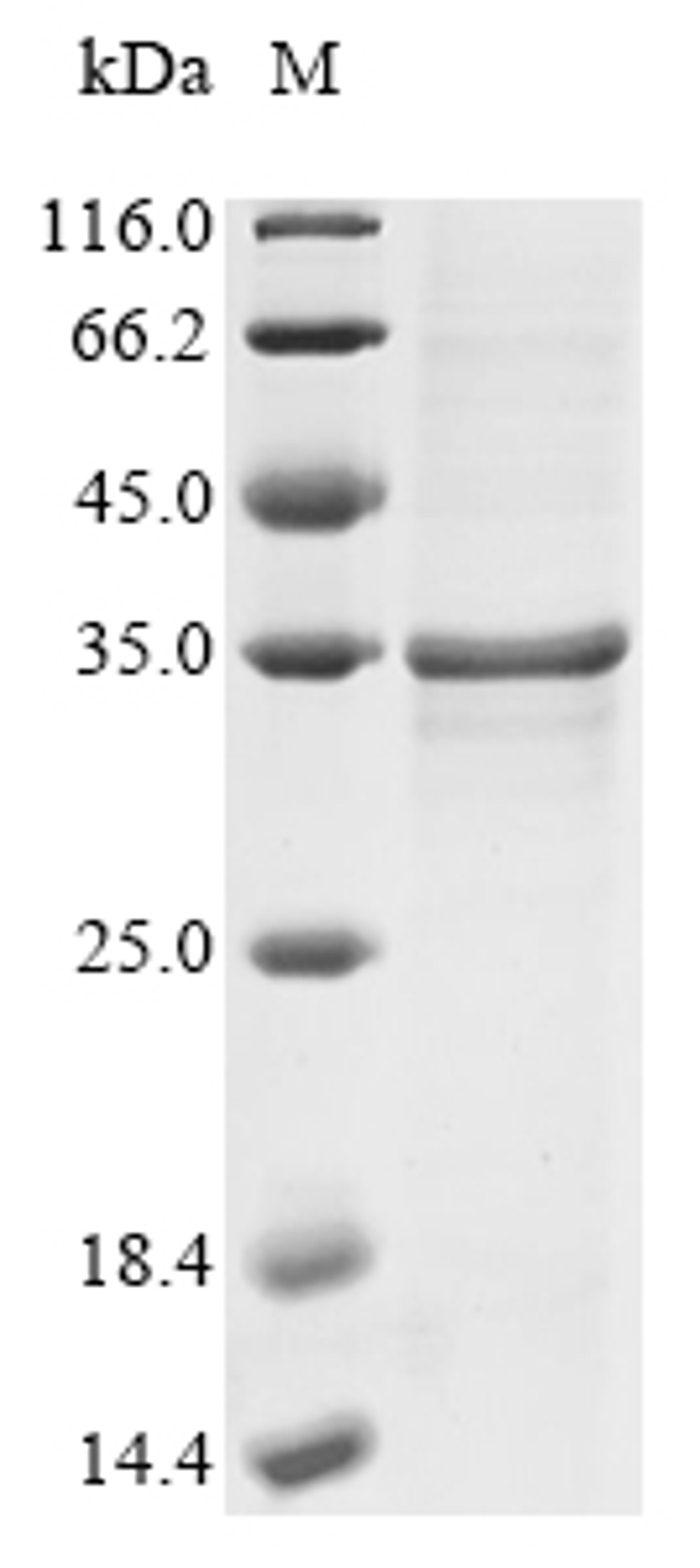 (Tris-Glycine gel) Discontinuous SDS-PAGE (reduced) with 5% enrichment gel and 15% separation gel.