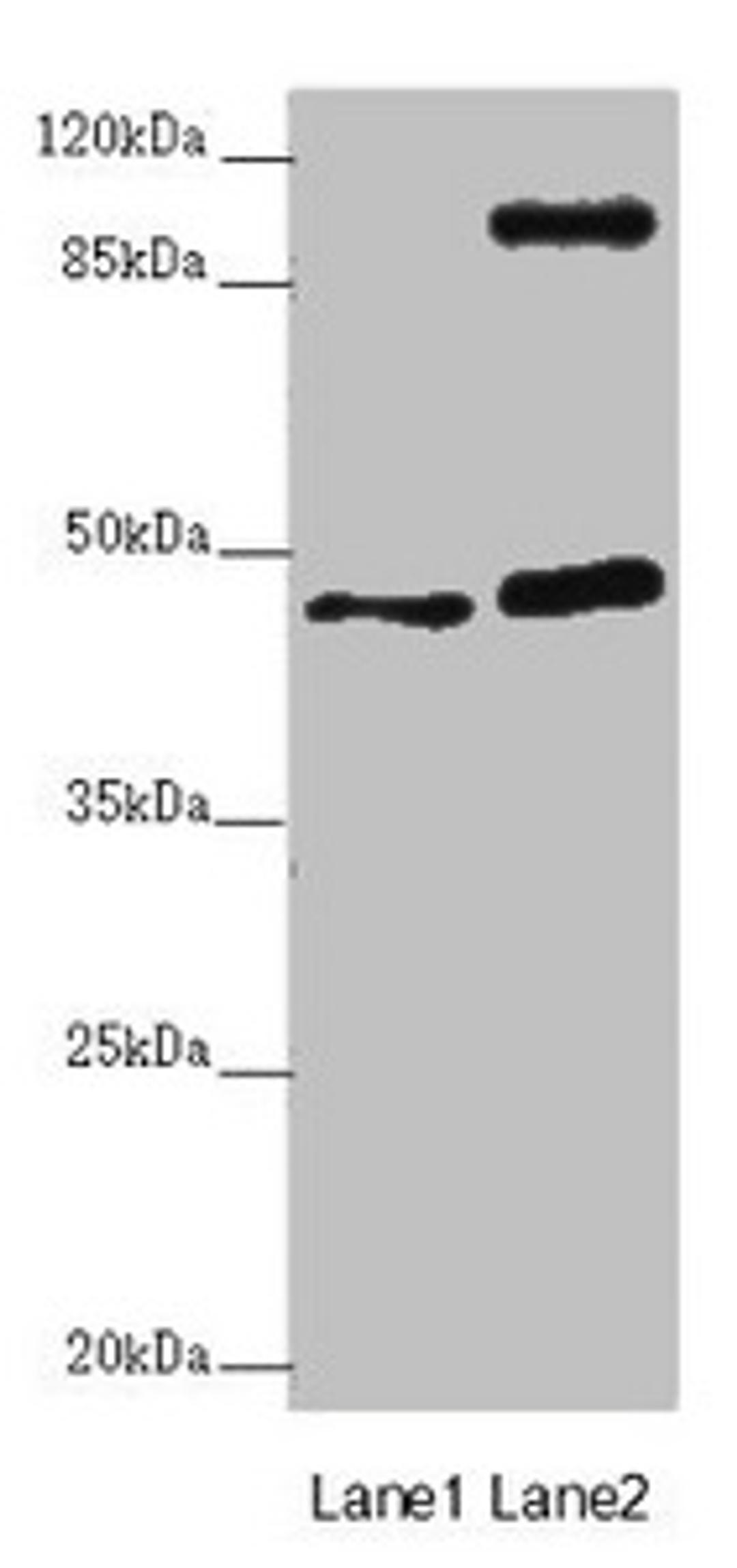 Western blot. All lanes: AURKA antibody at 2µg/ml. Lane 1: NIH/3T3 whole cell lysate. Lane 2: HT29 whole cell lysate. Secondary. Goat polyclonal to rabbit IgG at 1/10000 dilution. Predicted band size: 46 kDa. Observed band size: 46, 110 kDa